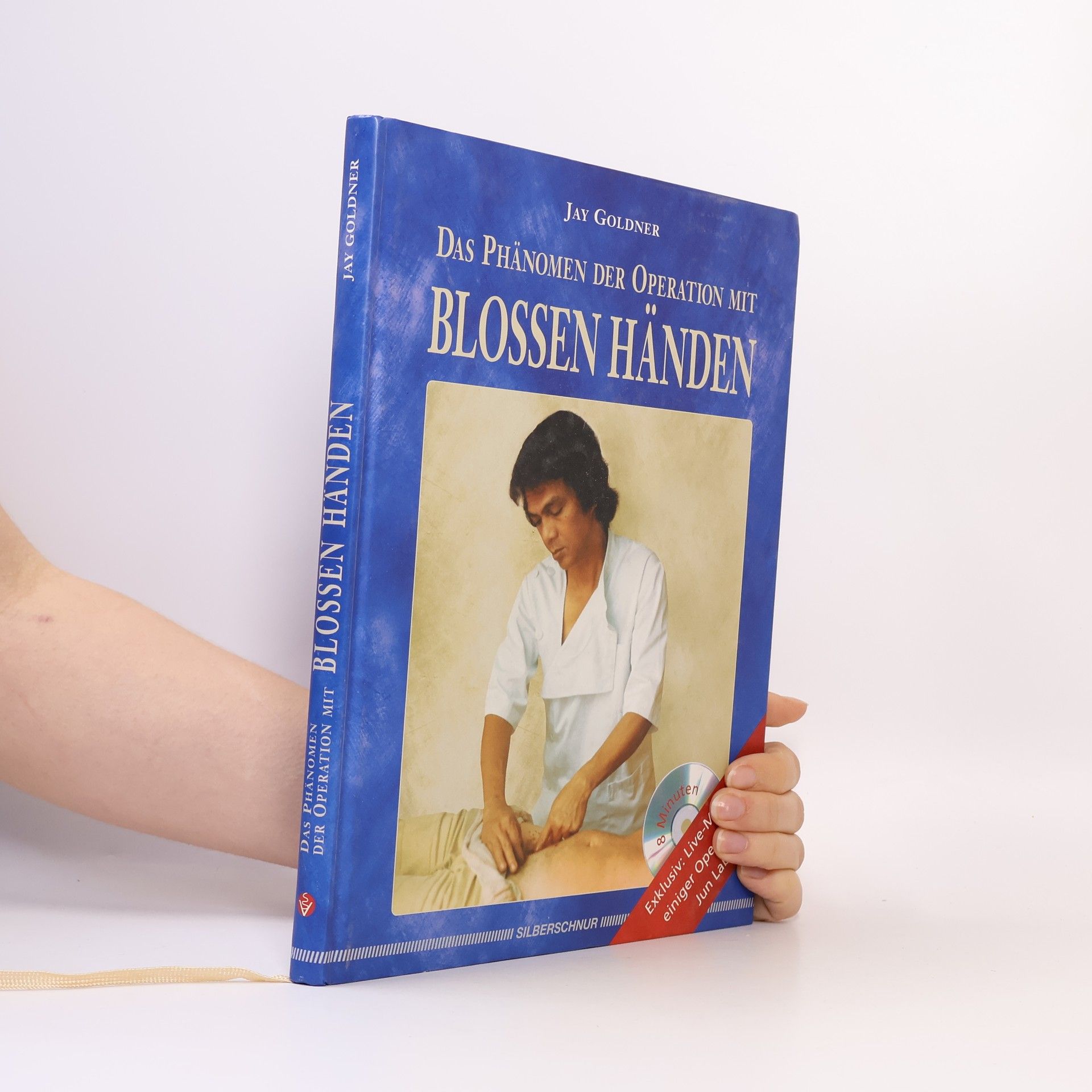 Jay Goldner Das Phänomen der Operation mit blossen Händen