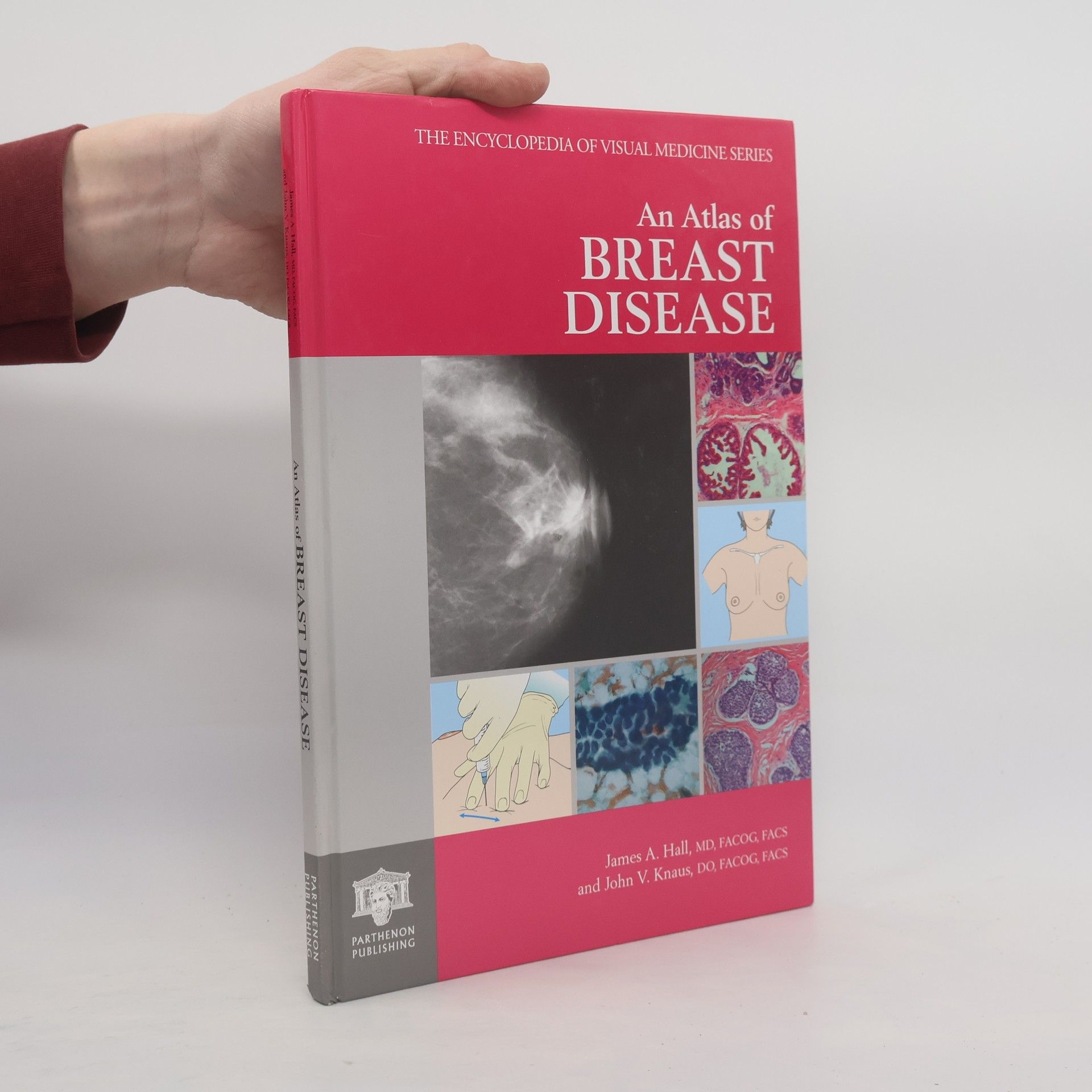 James A. Hall The Encyclopedia of Visual Medicine Series - 63: An Atlas of Breast Disease