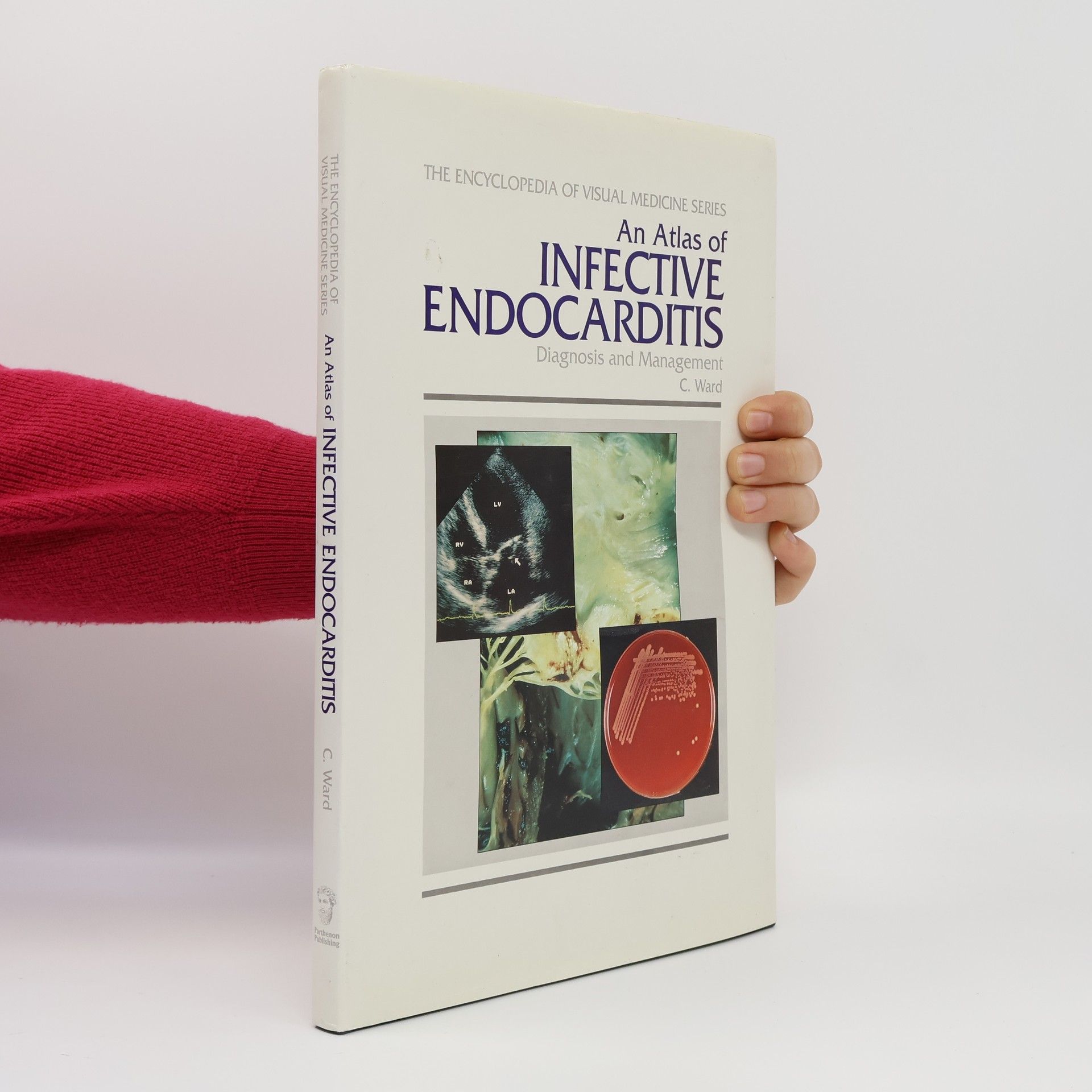 C. Ward The Encyclopedia of Visual Medicine Series - 16: An Atlas of Infective Endocarditis