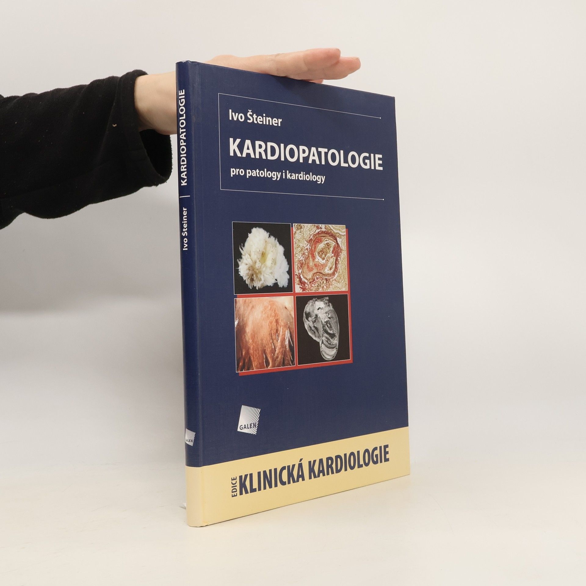 Ivo Šteiner Kardiopatologie
