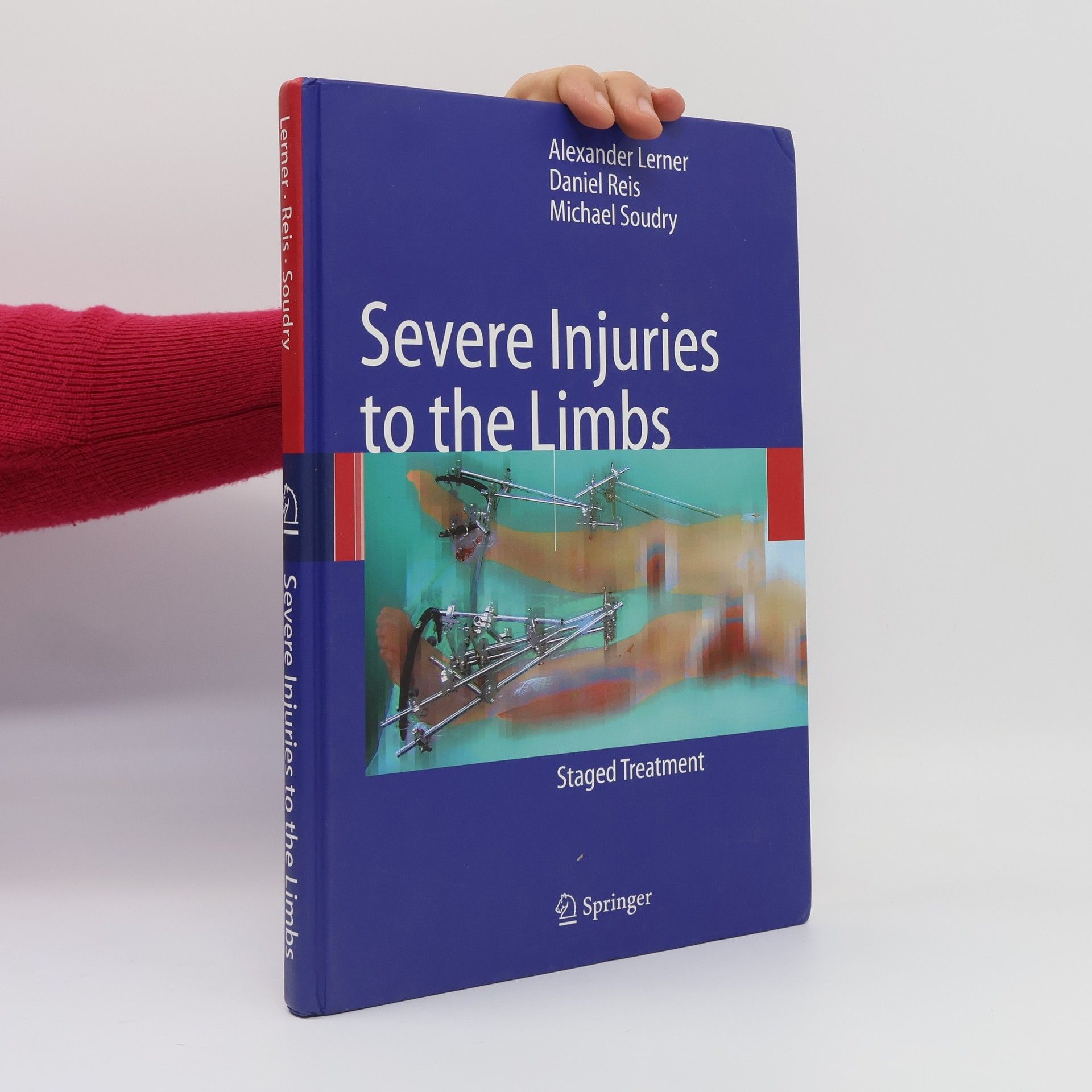 Alexander Lerner Severe Injuries to the Limbs