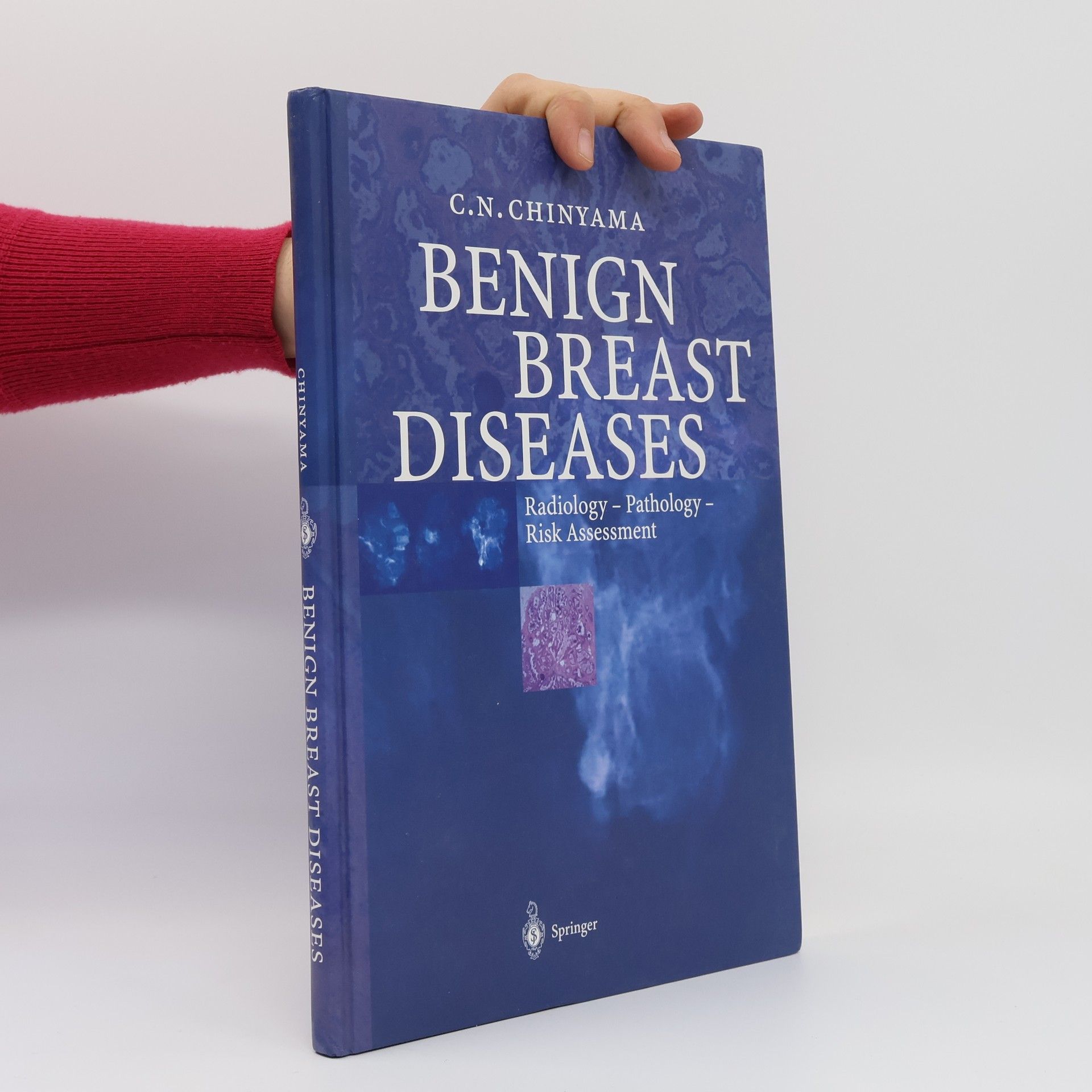 Catherine N. Chinyama Benign Breast Diseases