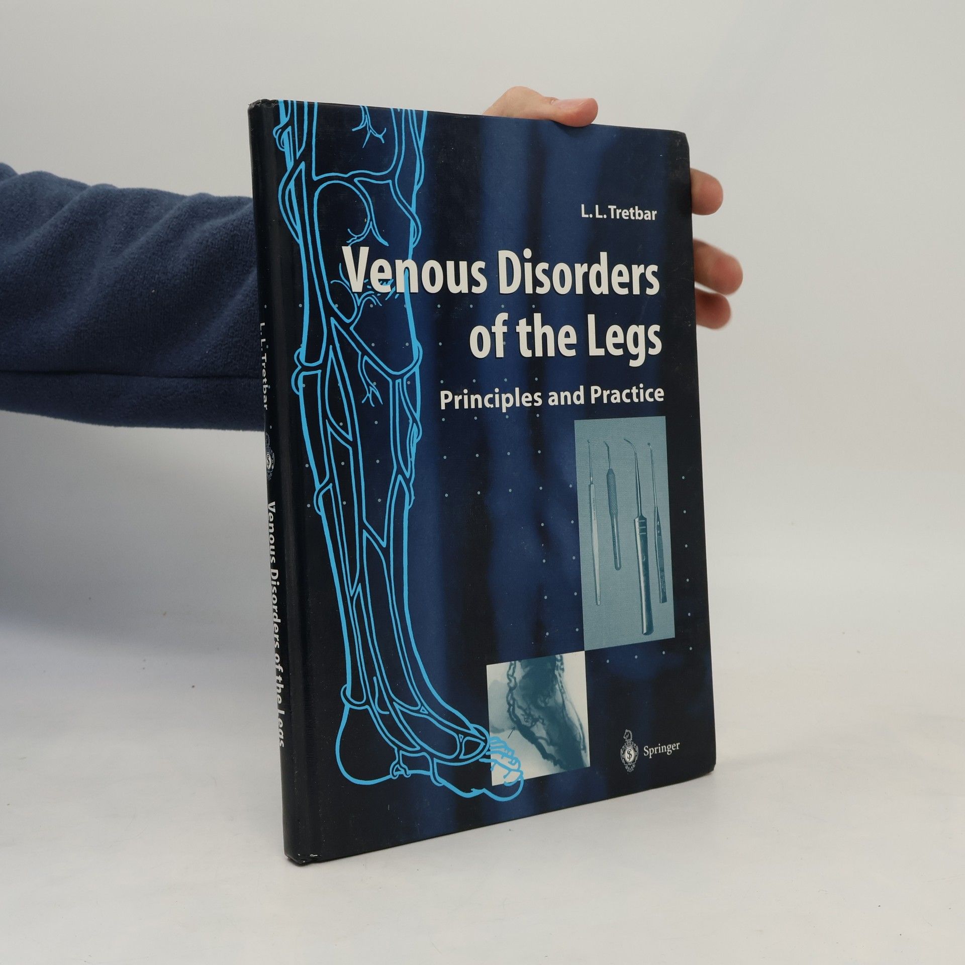 Lawrence L. Tretbar Venous Disorders of the Legs