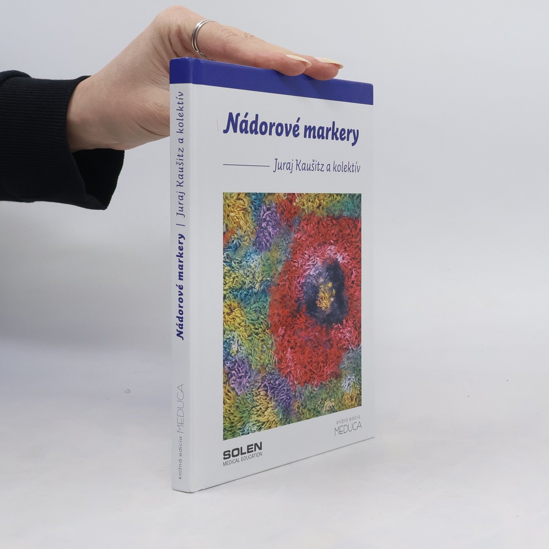 Juraj Kaušitz Nádorové markery