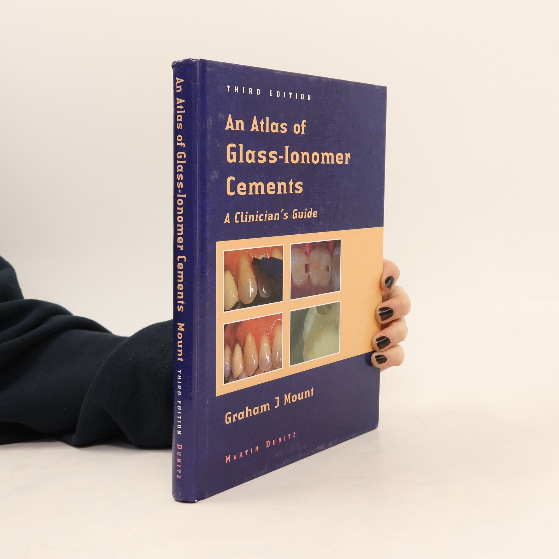 Graham J. Mount An Atlas of Glass-Ionomer Cements