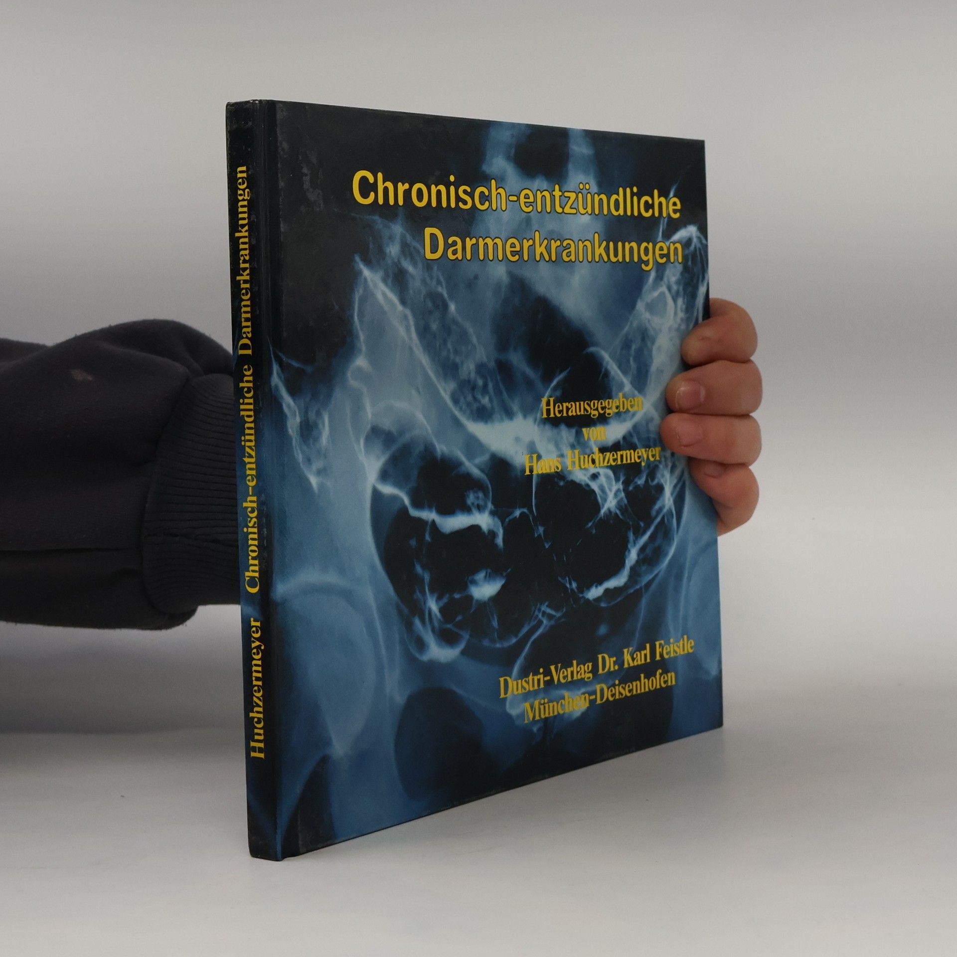 Hans Huchzermeyer Chronisch-entzündliche Darmerkrankungen