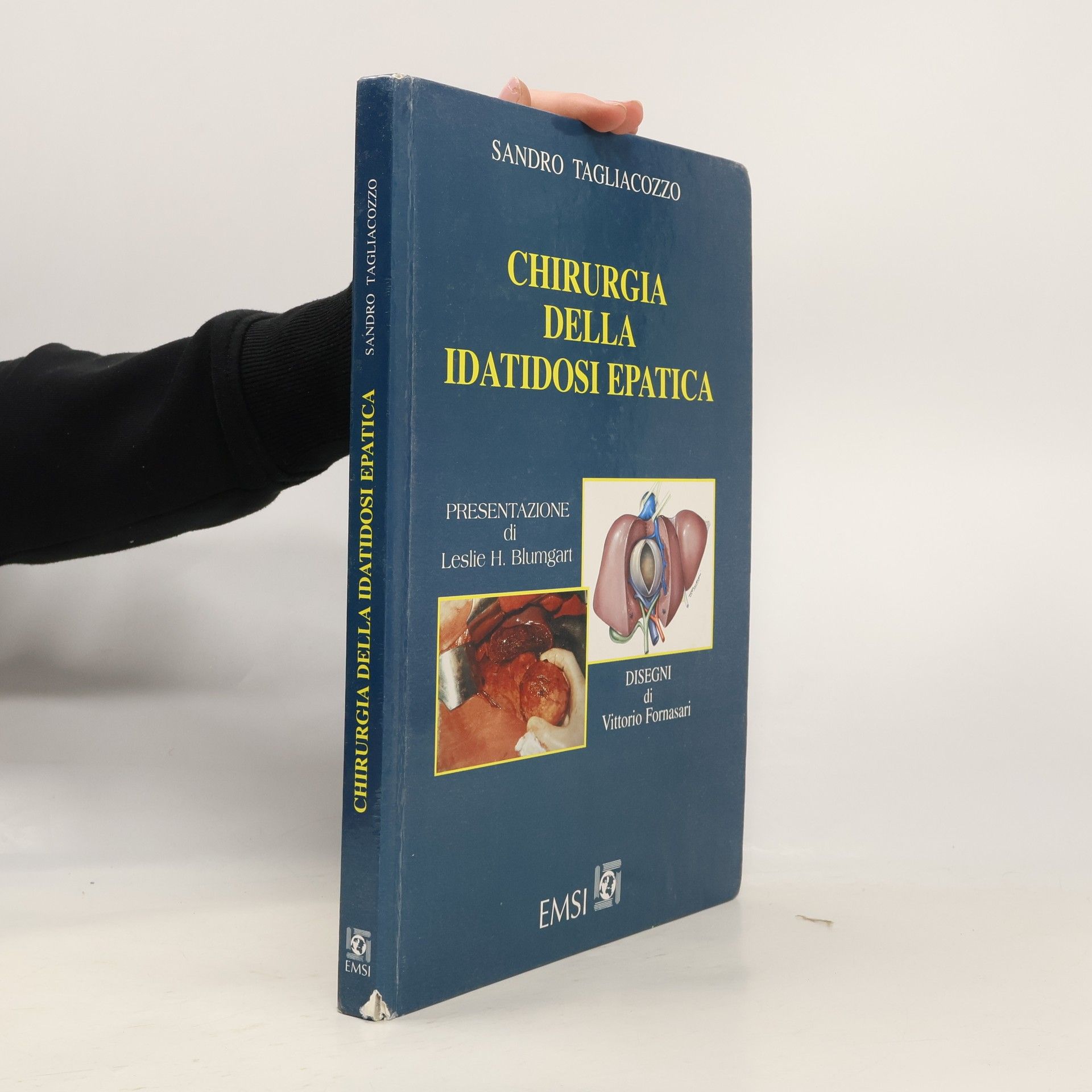 Sandro Tagliacozzo Chirurgia della idatidosi epatica