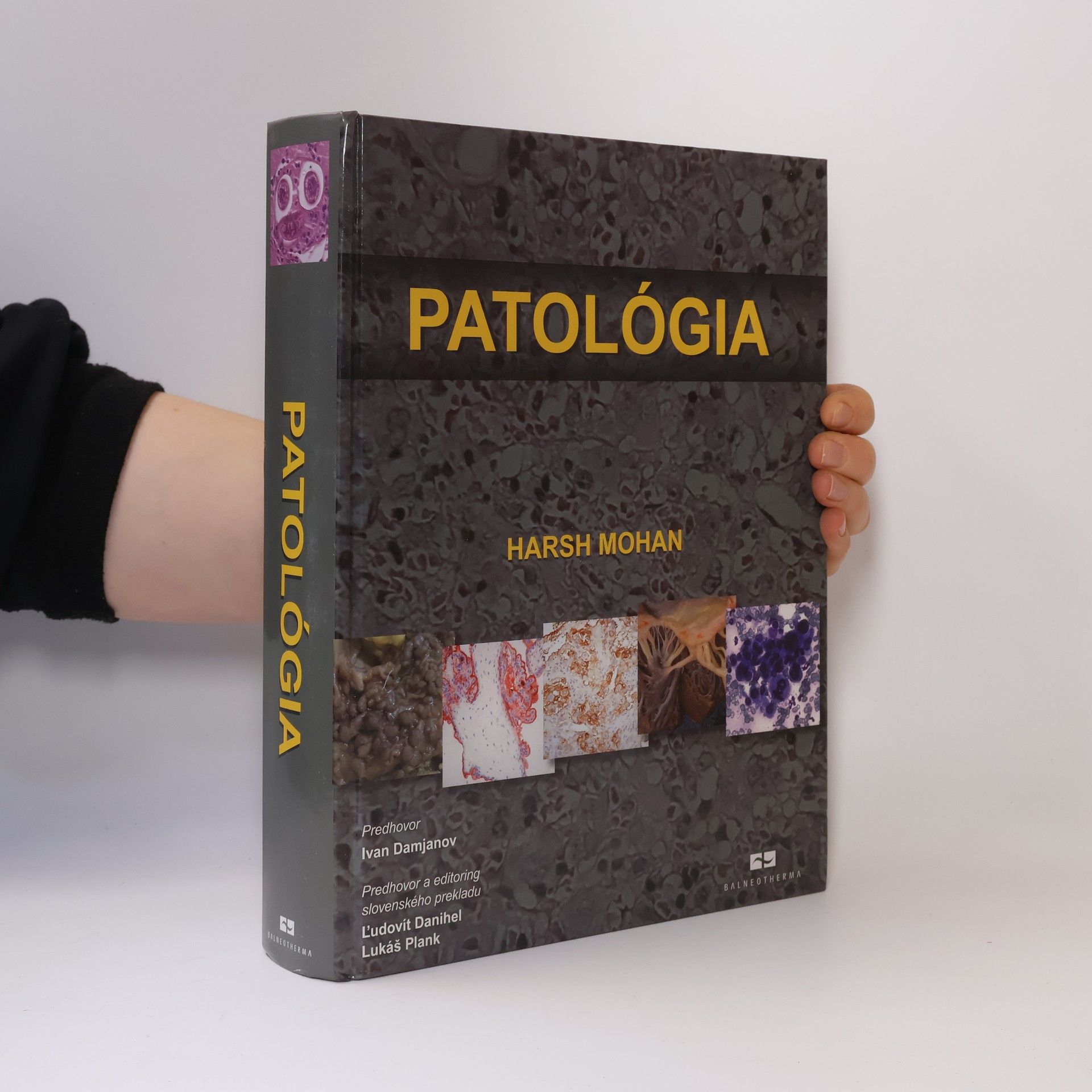 Harsh Mohan Patológia