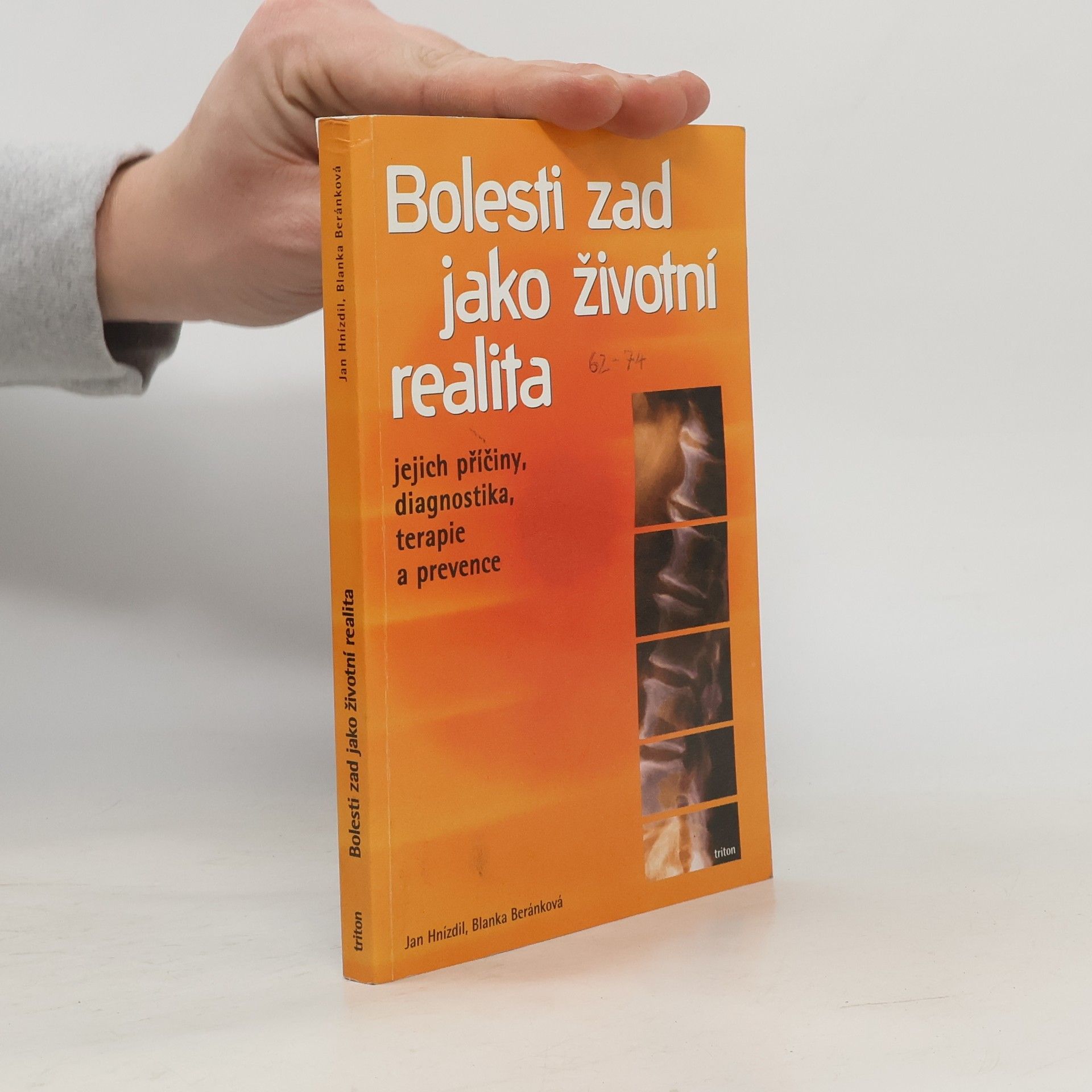 Jan Hnízdil Bolesti zad jako životní realita. Jejich příčiny, diagnostika, terapie a prevence