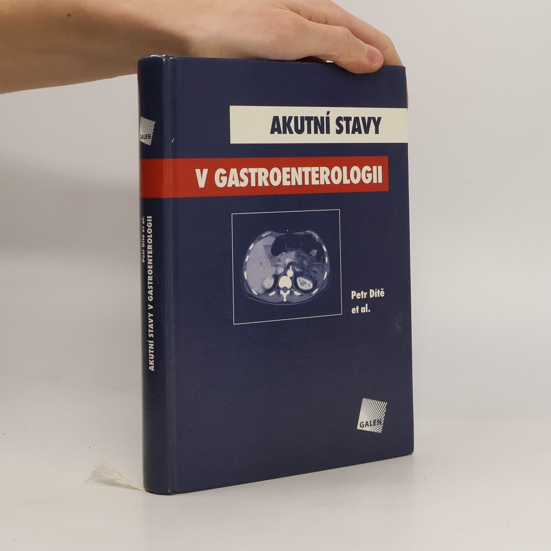 Petr Dítě Akutní stavy v gastroenterologii