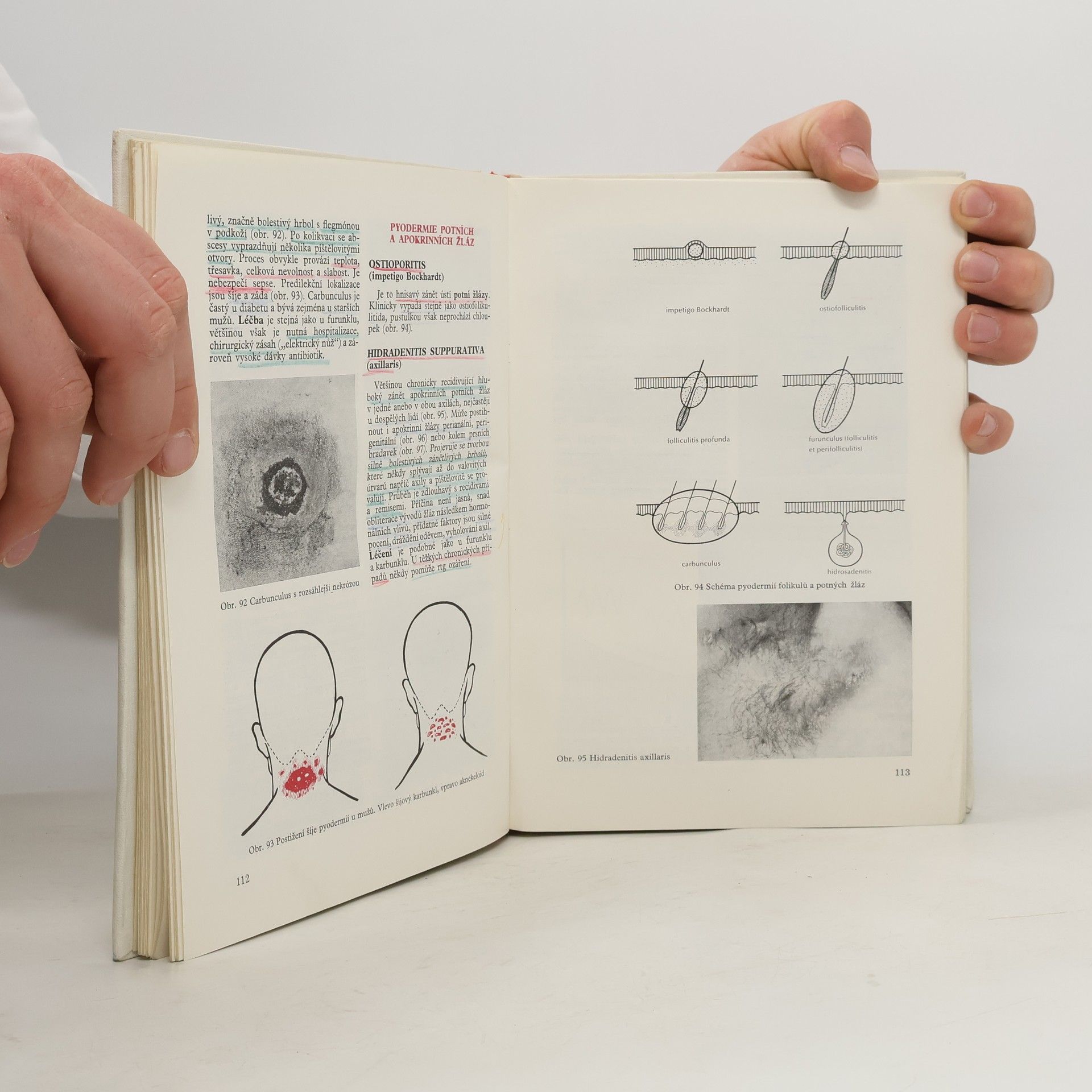 Autorenkollektiv Dermatovenerologie