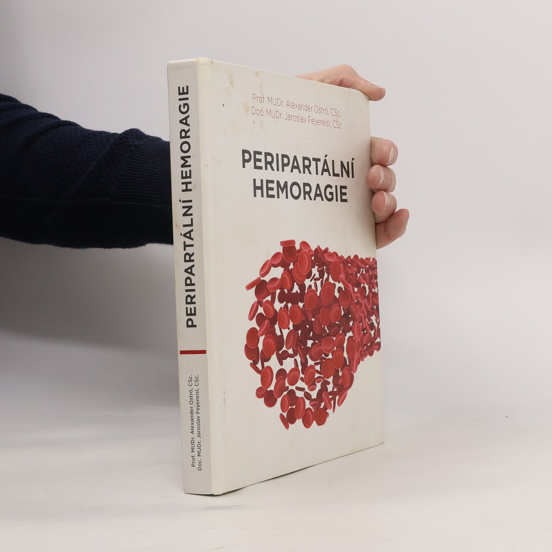 Peripartální hemoragie