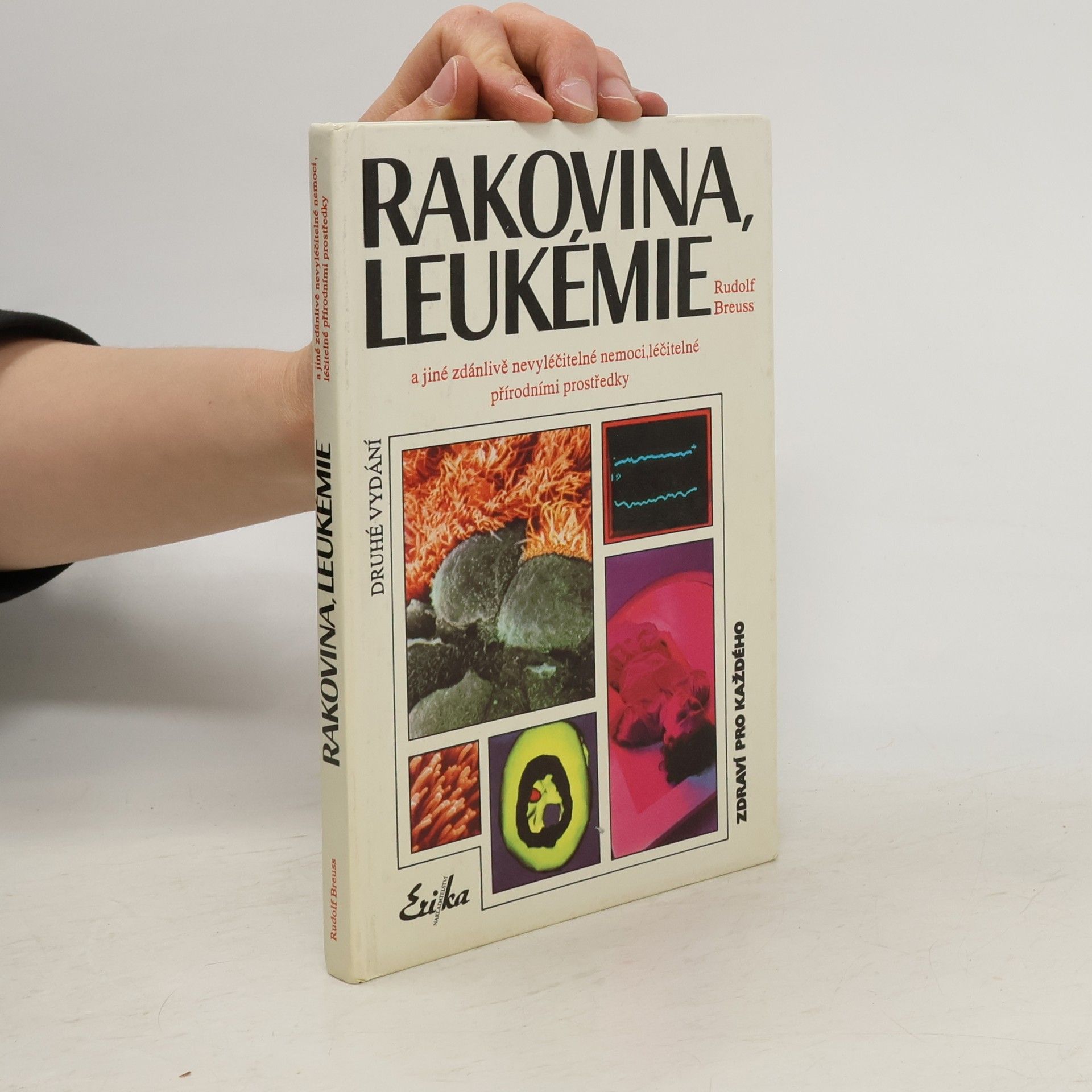 Rudolf Breuss Rakovina, leukémie a jiné zdánlivě nevyléčitelné nemoci, které jsou léčitelné přírodními prostředky: Záznamy z tisíců zkušeností k blahu všeho lidstva na přání mnoha vyléčených pacientů a také na přání dobrých lékařů
