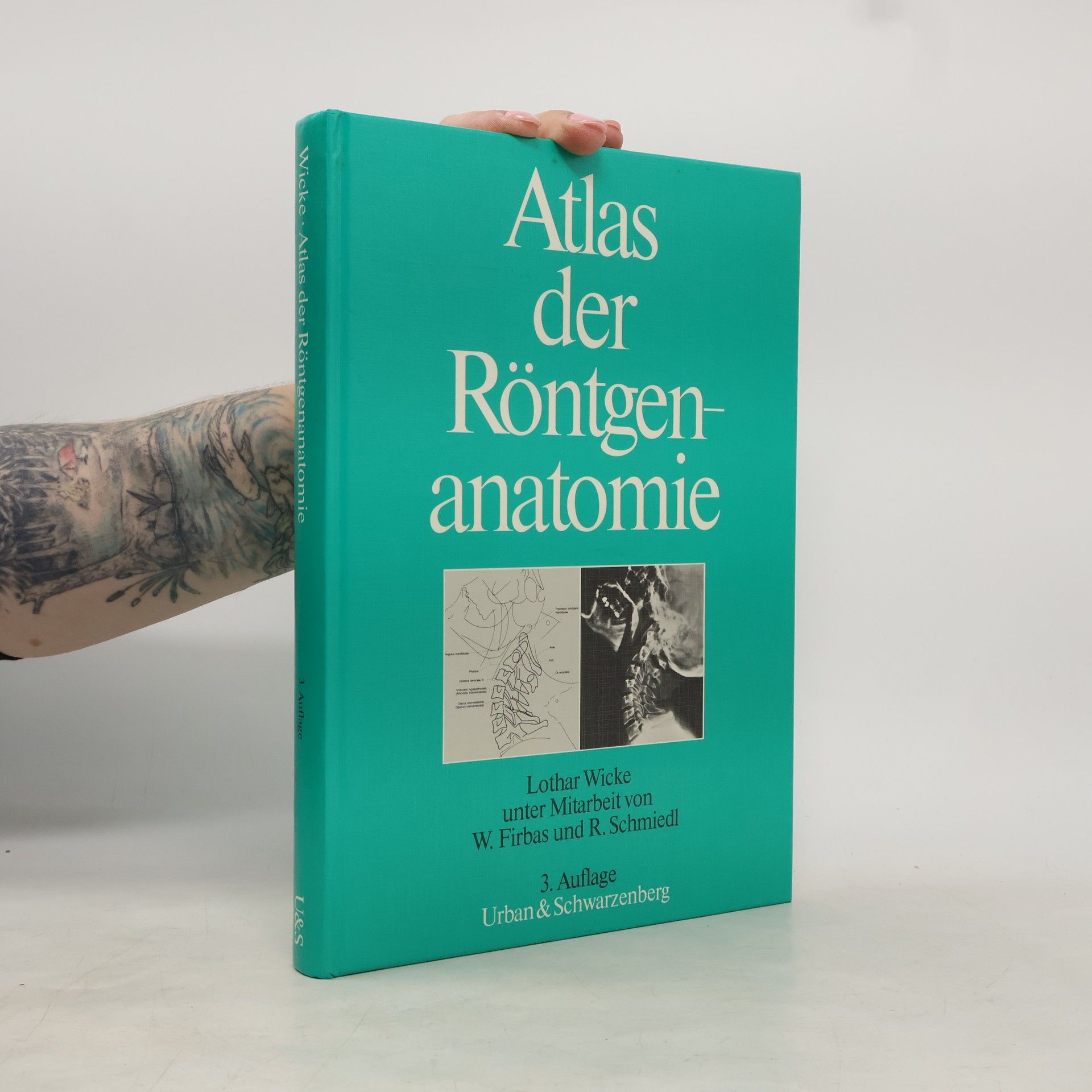 Lothar Wicke Atlas der Röntgenanatomie