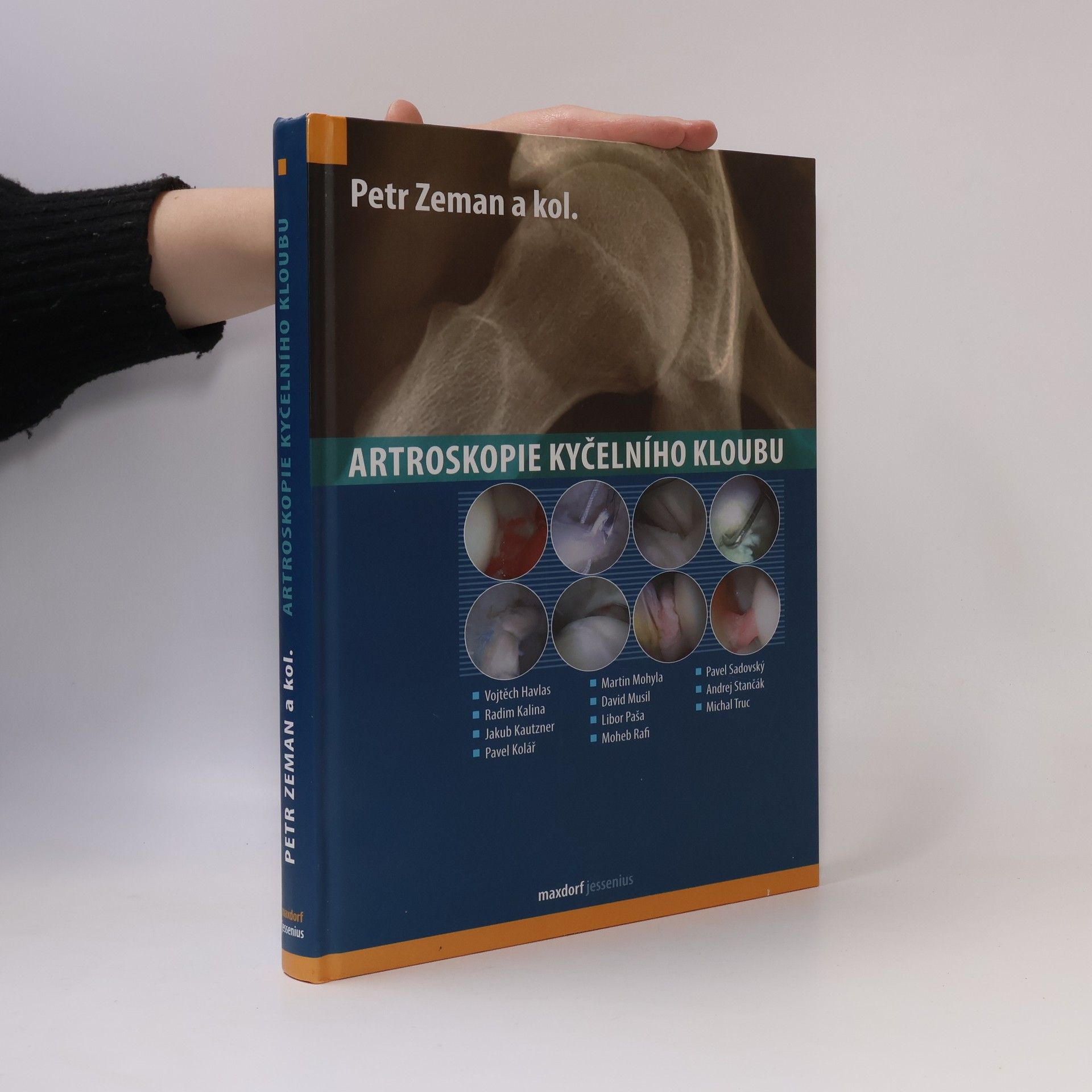 Petr Zeman Artroskopie kyčelního kloubu