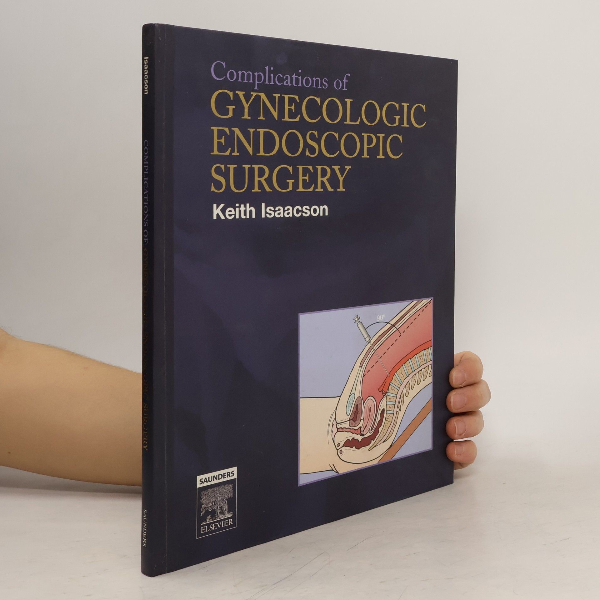 Keith B. Isaacson Complications of Gynecologic Endoscopic Surgery