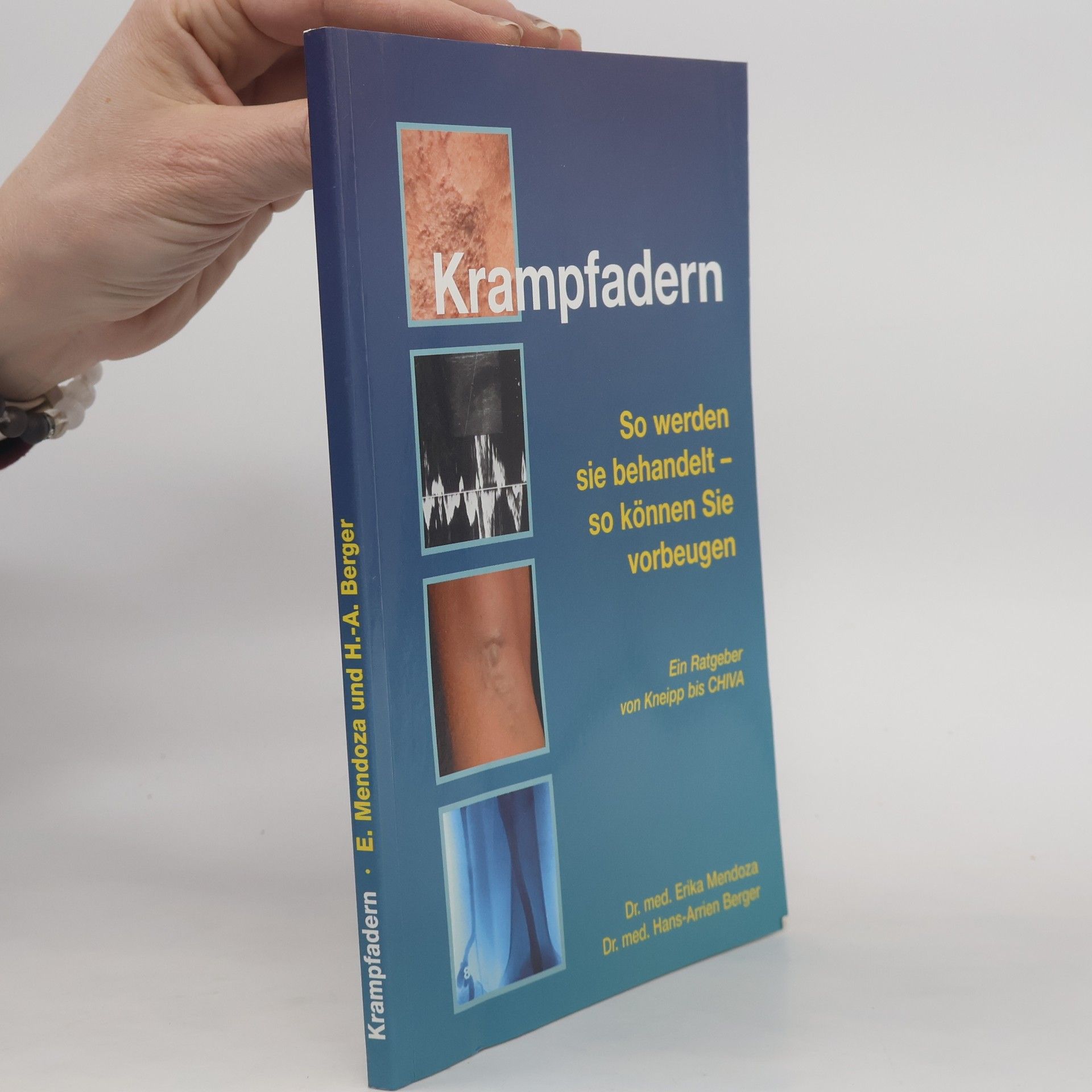 Erika Mendoza Krampfadern