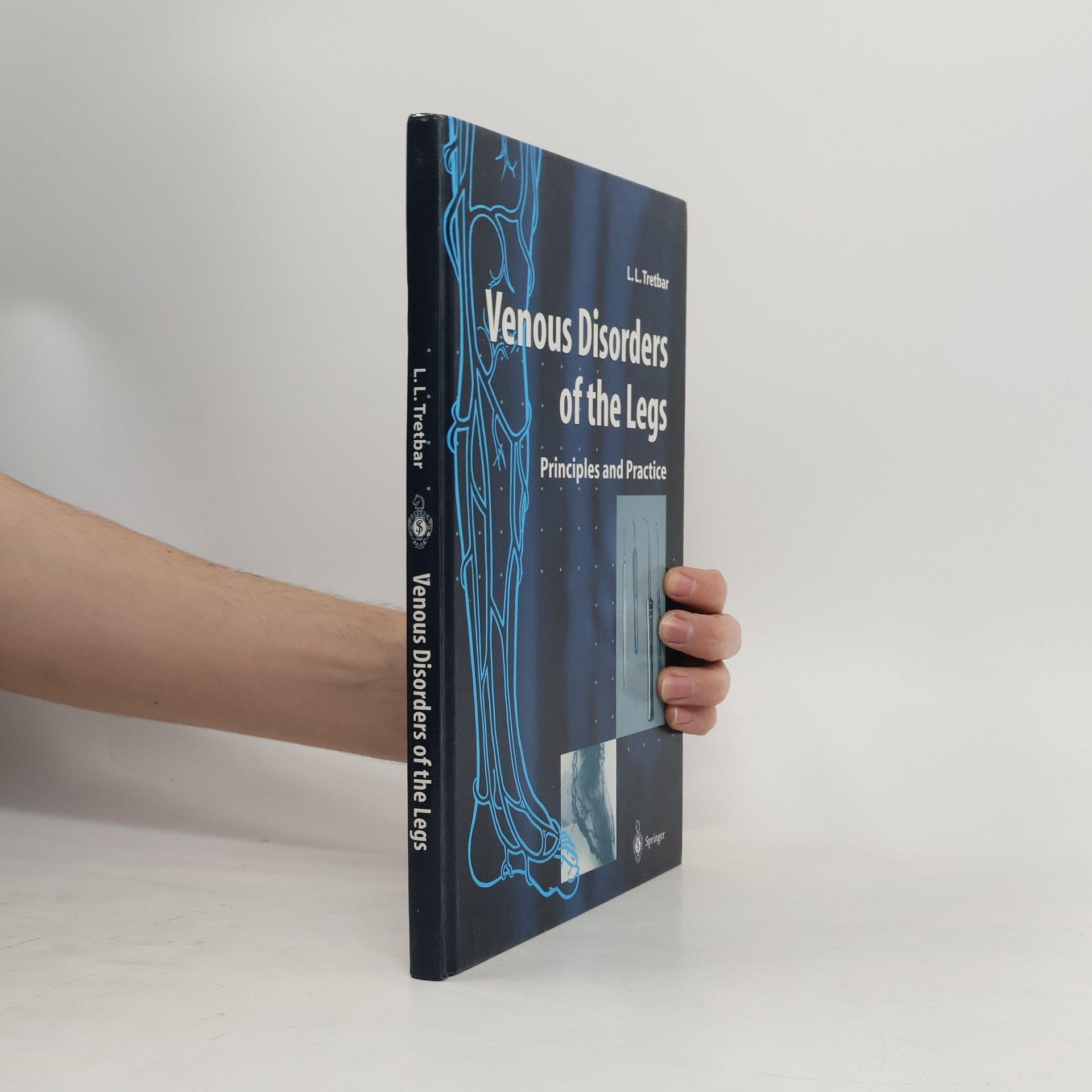 Lawrence L. Tretbar Venous Disorders of the Legs