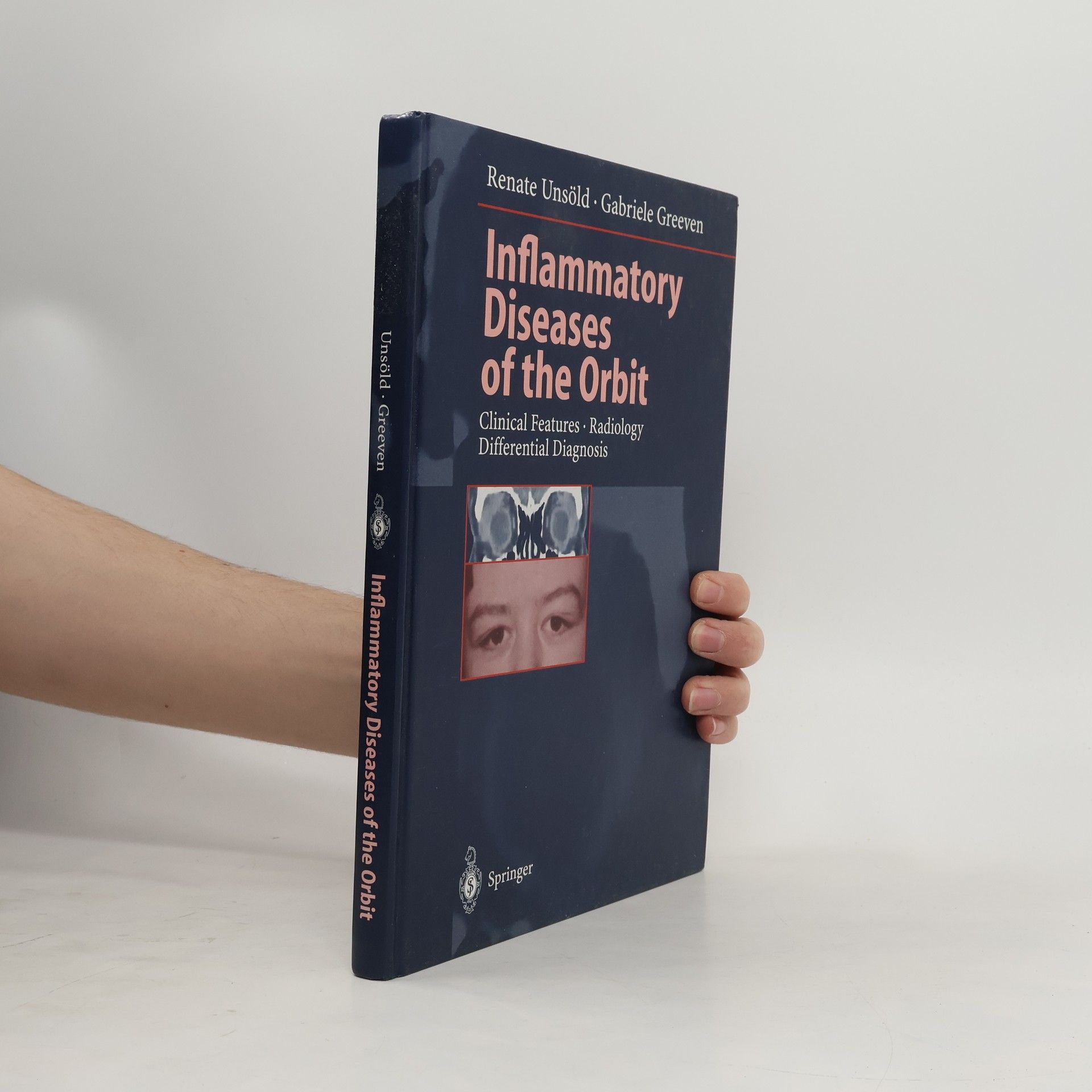 Renate Unsöld Inflammatory Diseases of the Orbit