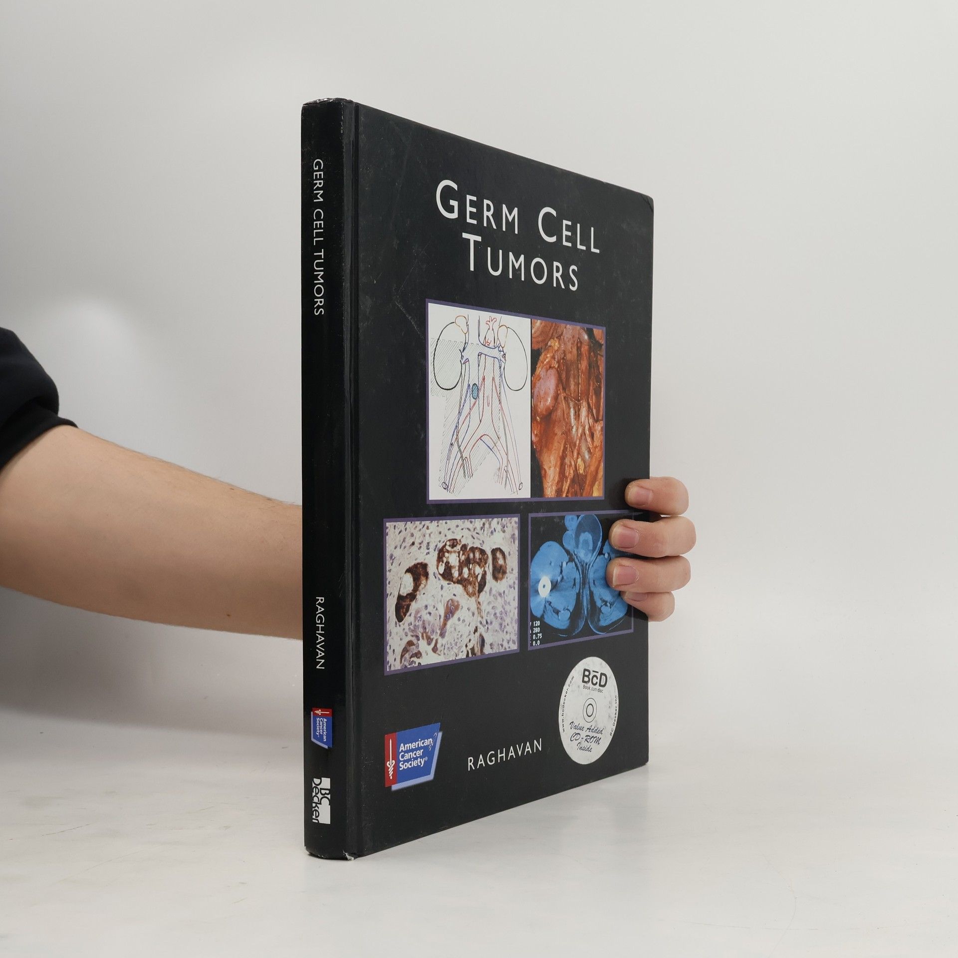 Derek Raghavan Germ Cell Tumors