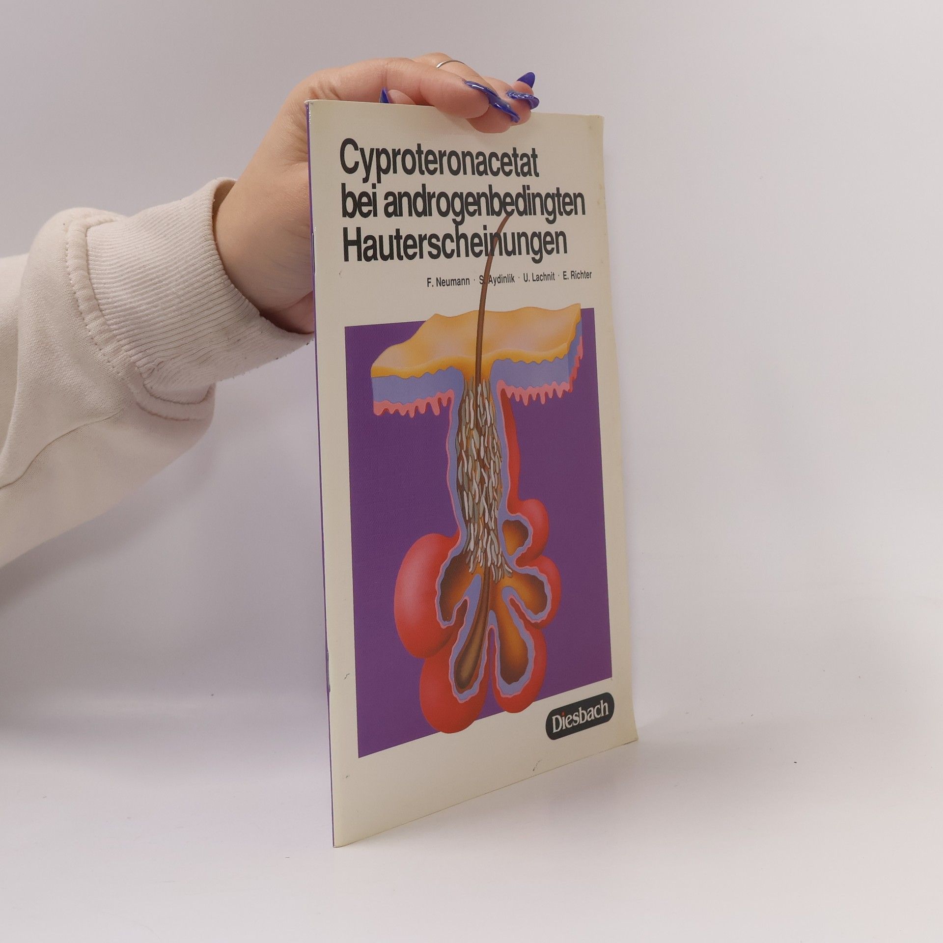 Friedmund Neumann Cyproterone acetate for the treatment of androgenisation