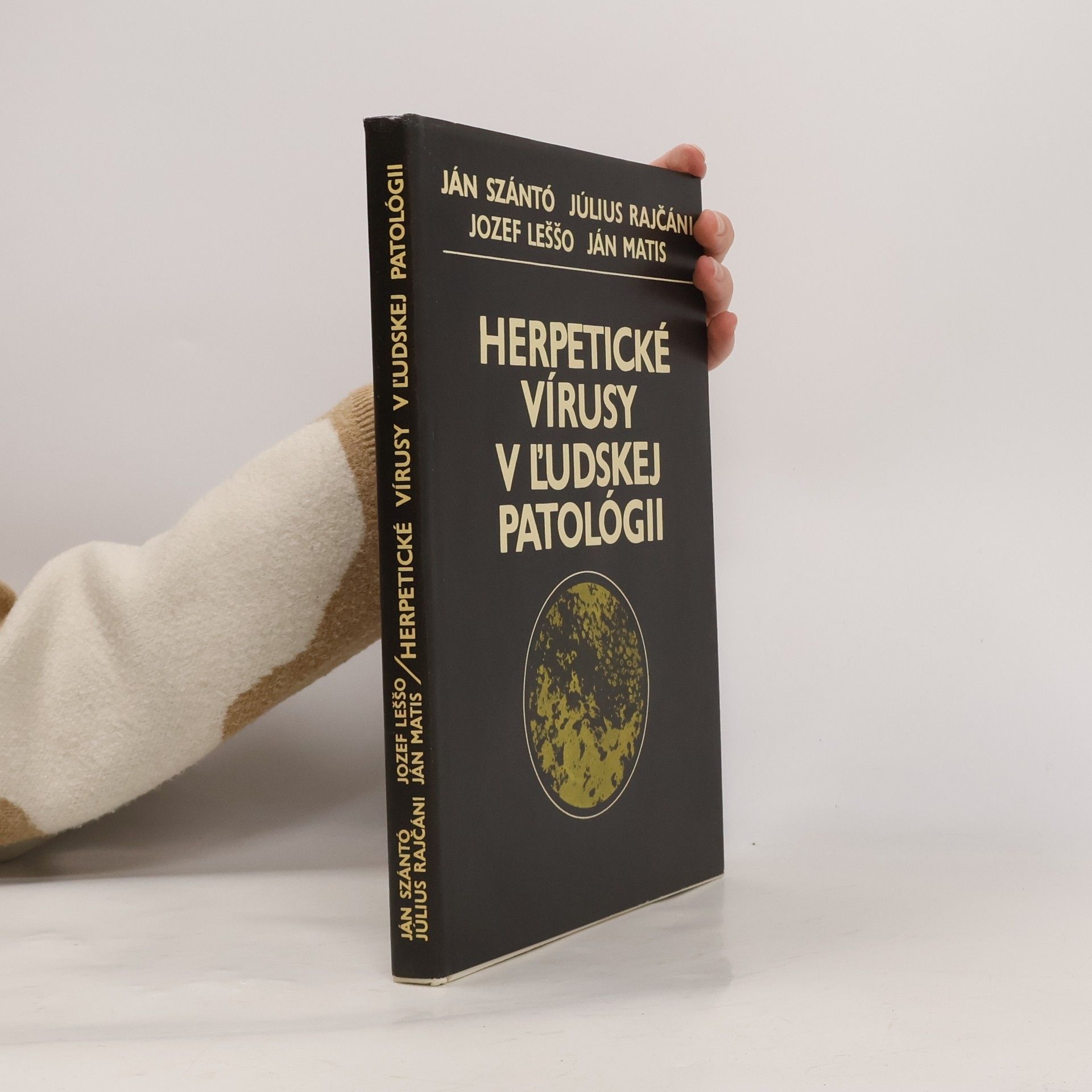 Ján Szántó Herpetické vírusy v l'udskej patológii