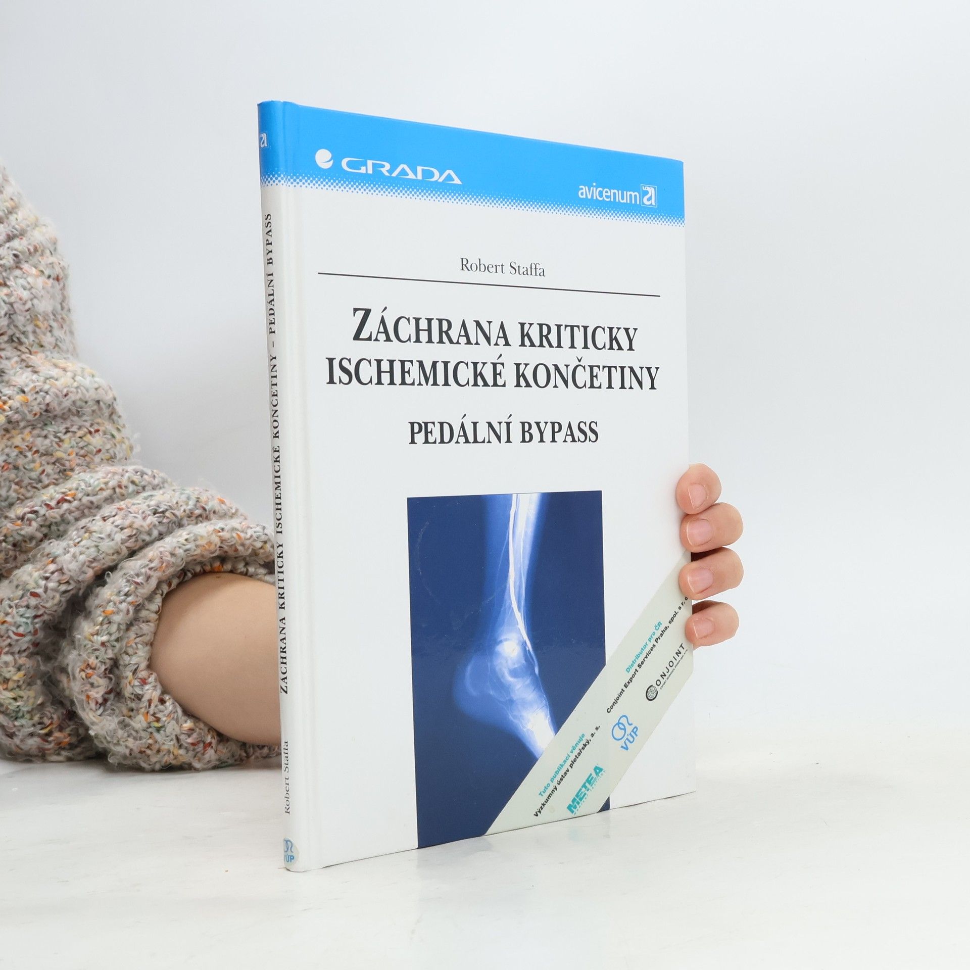 Robert Staffa Záchrana kriticky ischemické končetiny. Pedální bypass