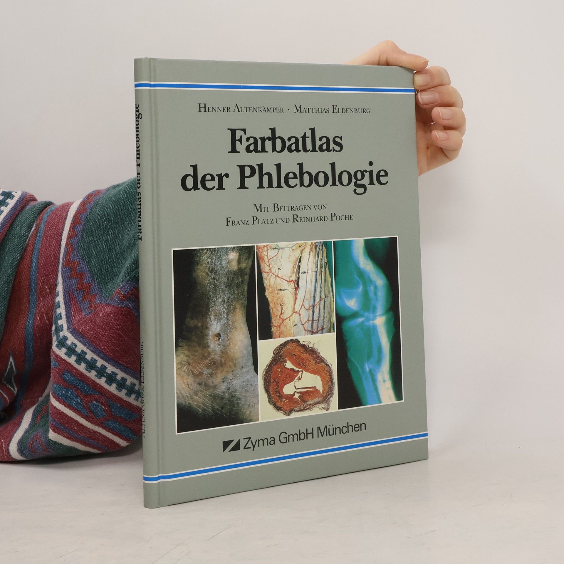 Henner Altenkämper Farbatlas der Phlebologie