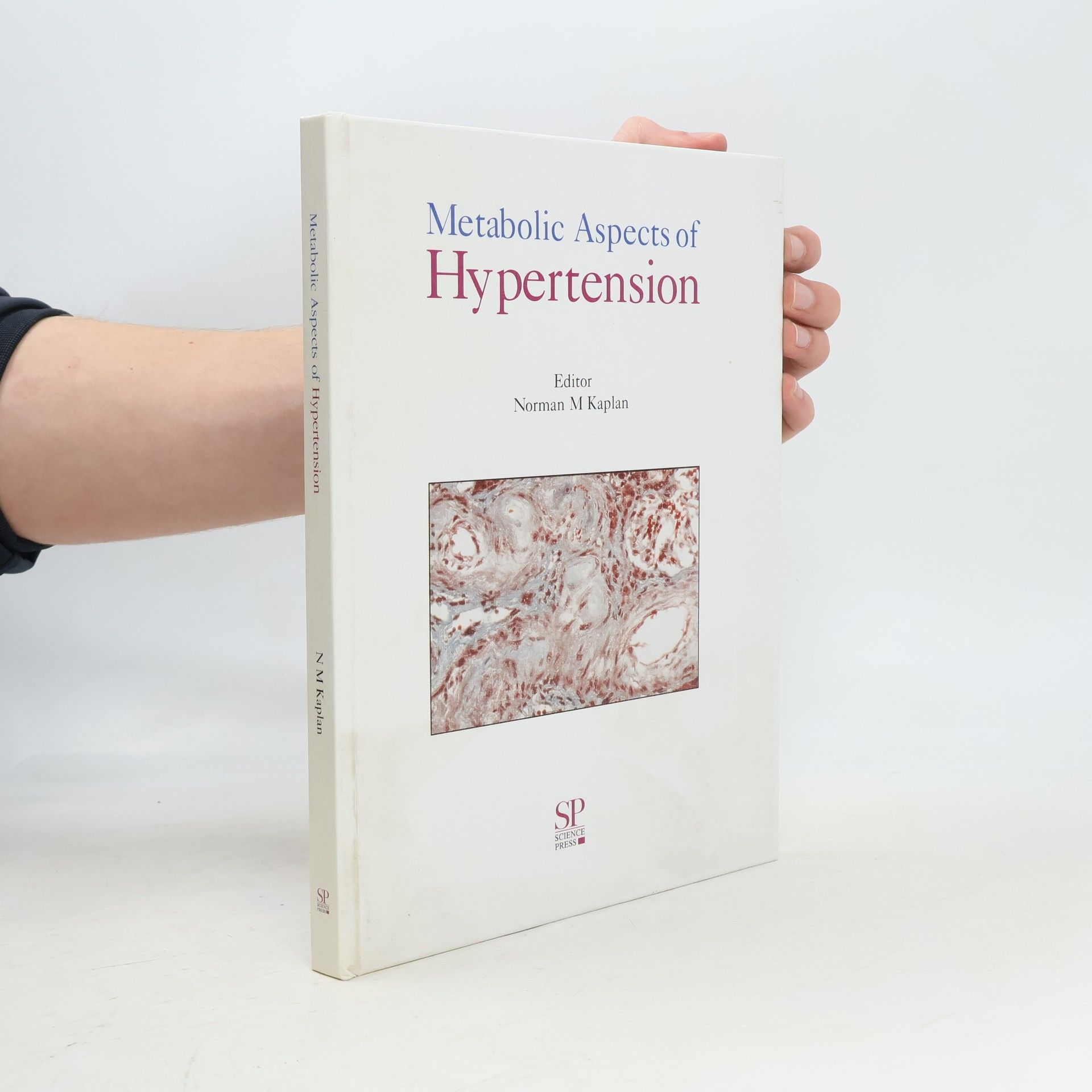 Norman M. Kaplan Metabolic Aspects of Hypertension