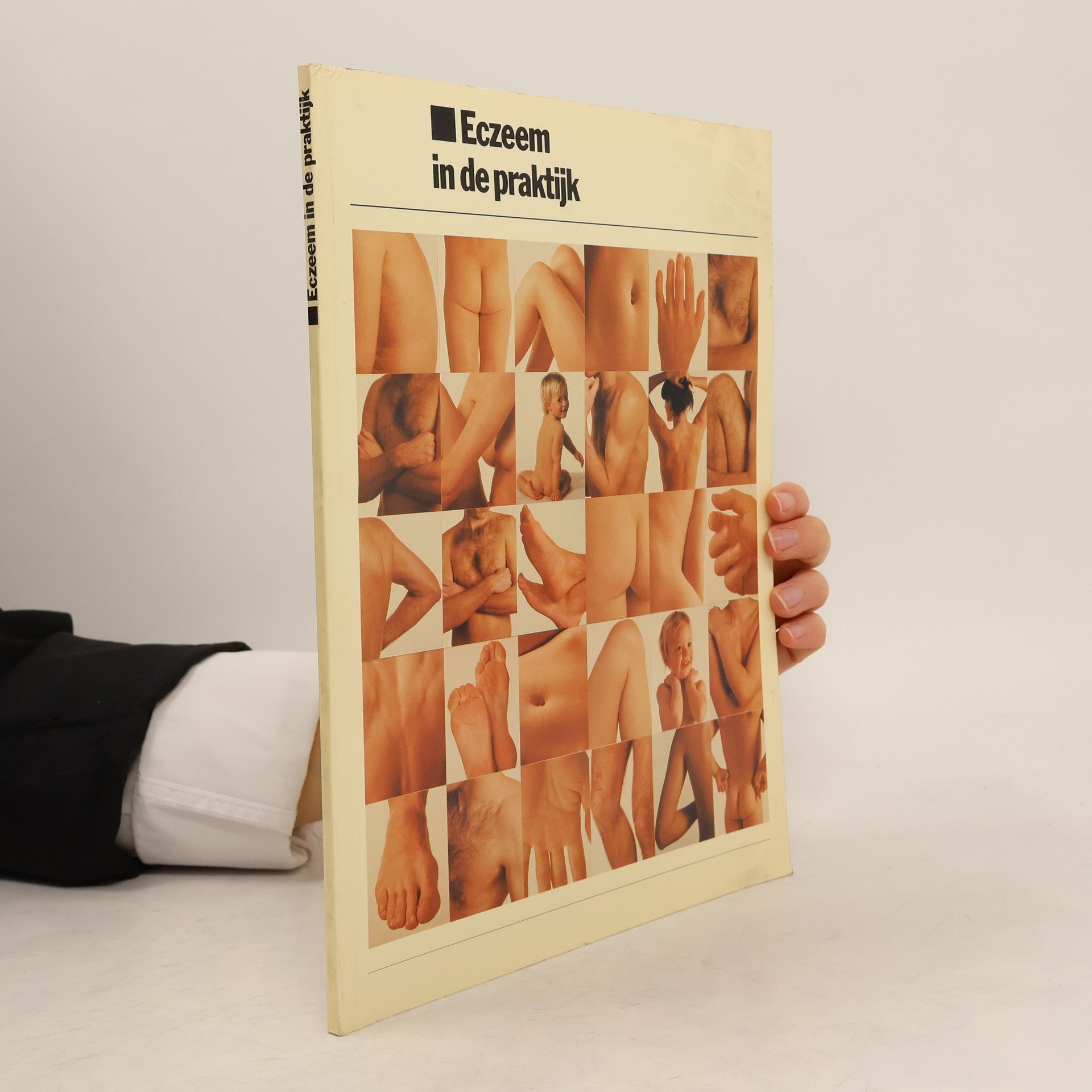 Autorenkollektiv Ekzeme in der Praxis