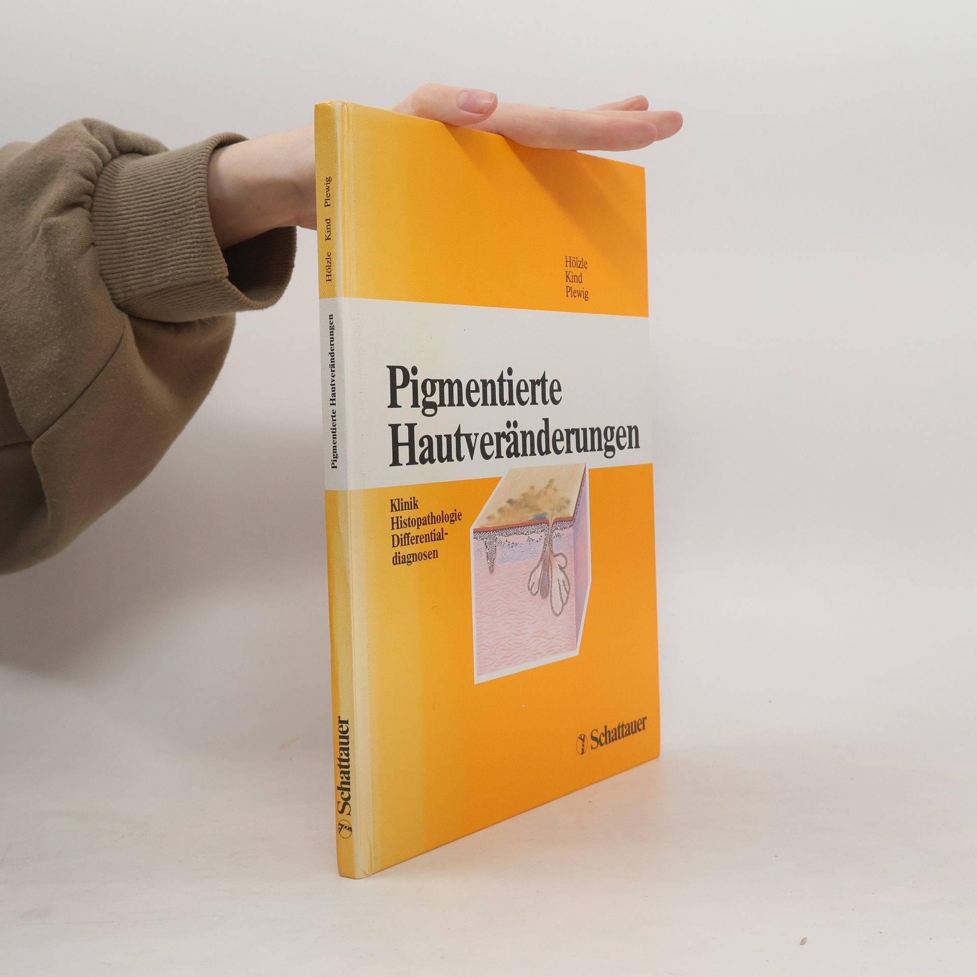 Erhard Hölzle Pigmentierte Hautveränderungen