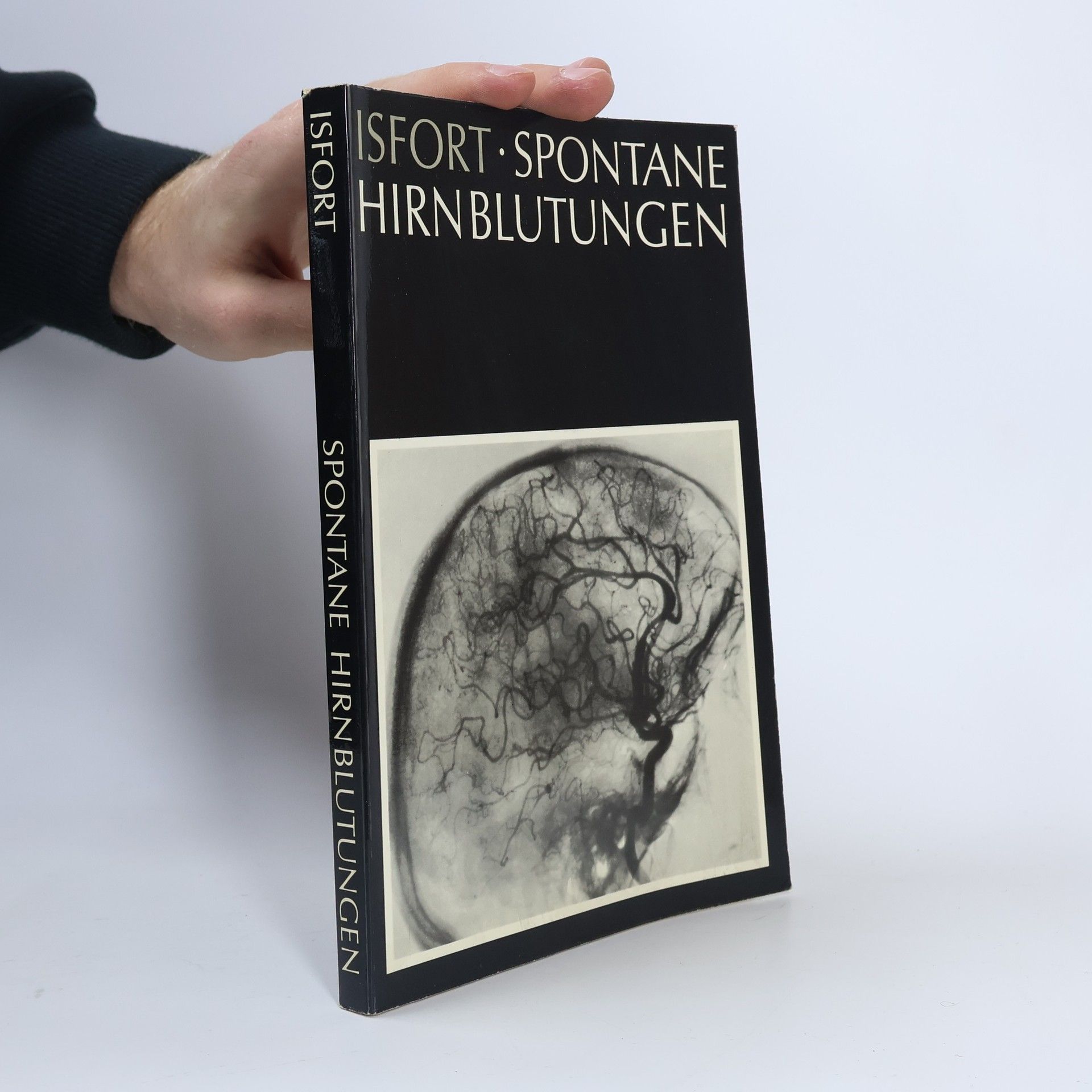 Alfons Isfort Spontane Hirnblutungen