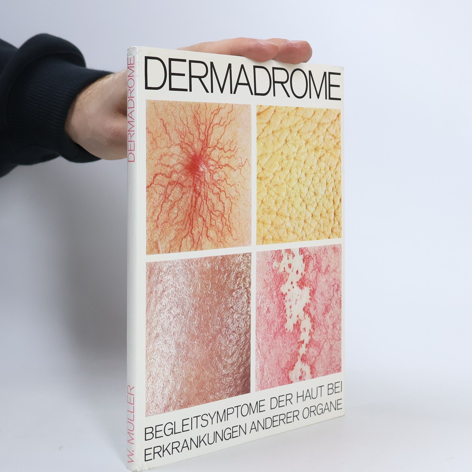 W. Müller Dermadrome