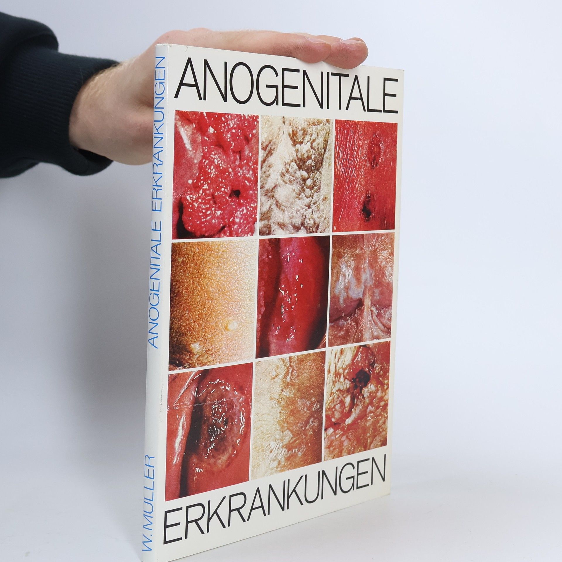 Werner Müller Anogenitale Erkrankungen