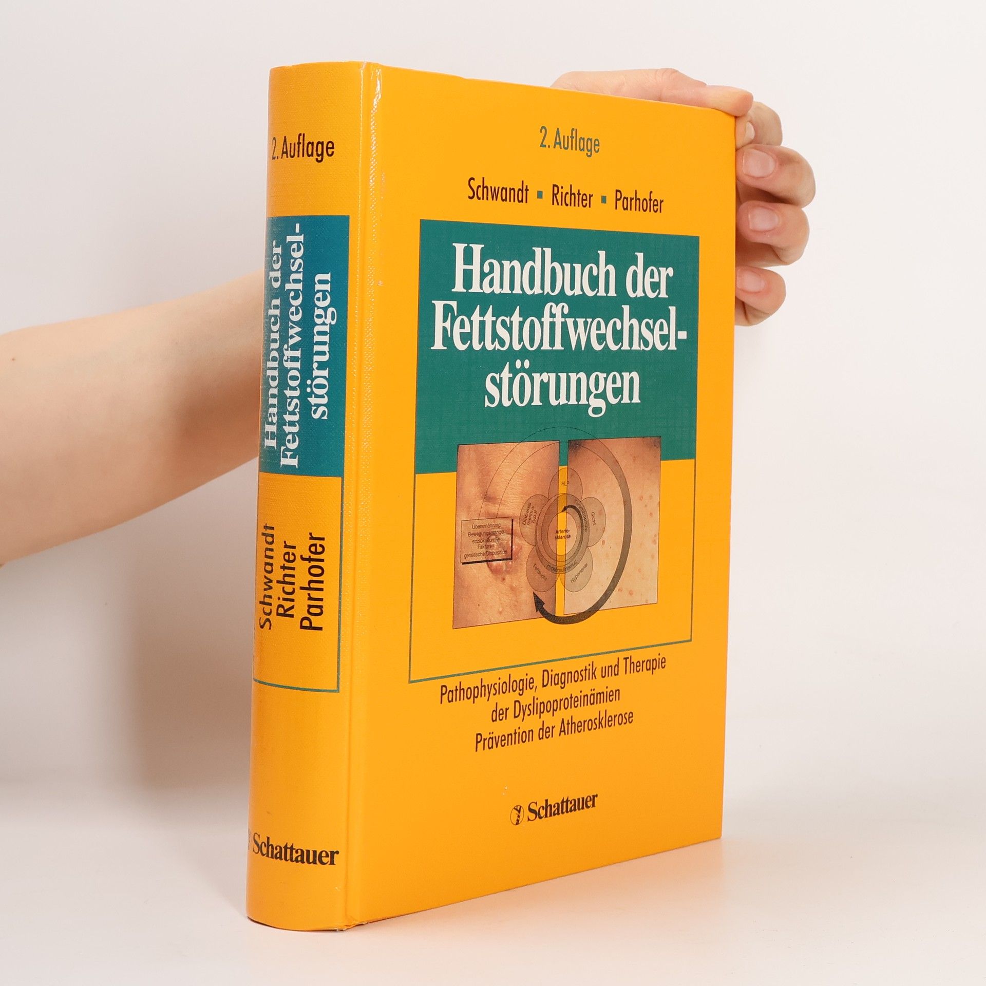 Peter Schwandt Handbuch der Fettstoffwechselstörungen