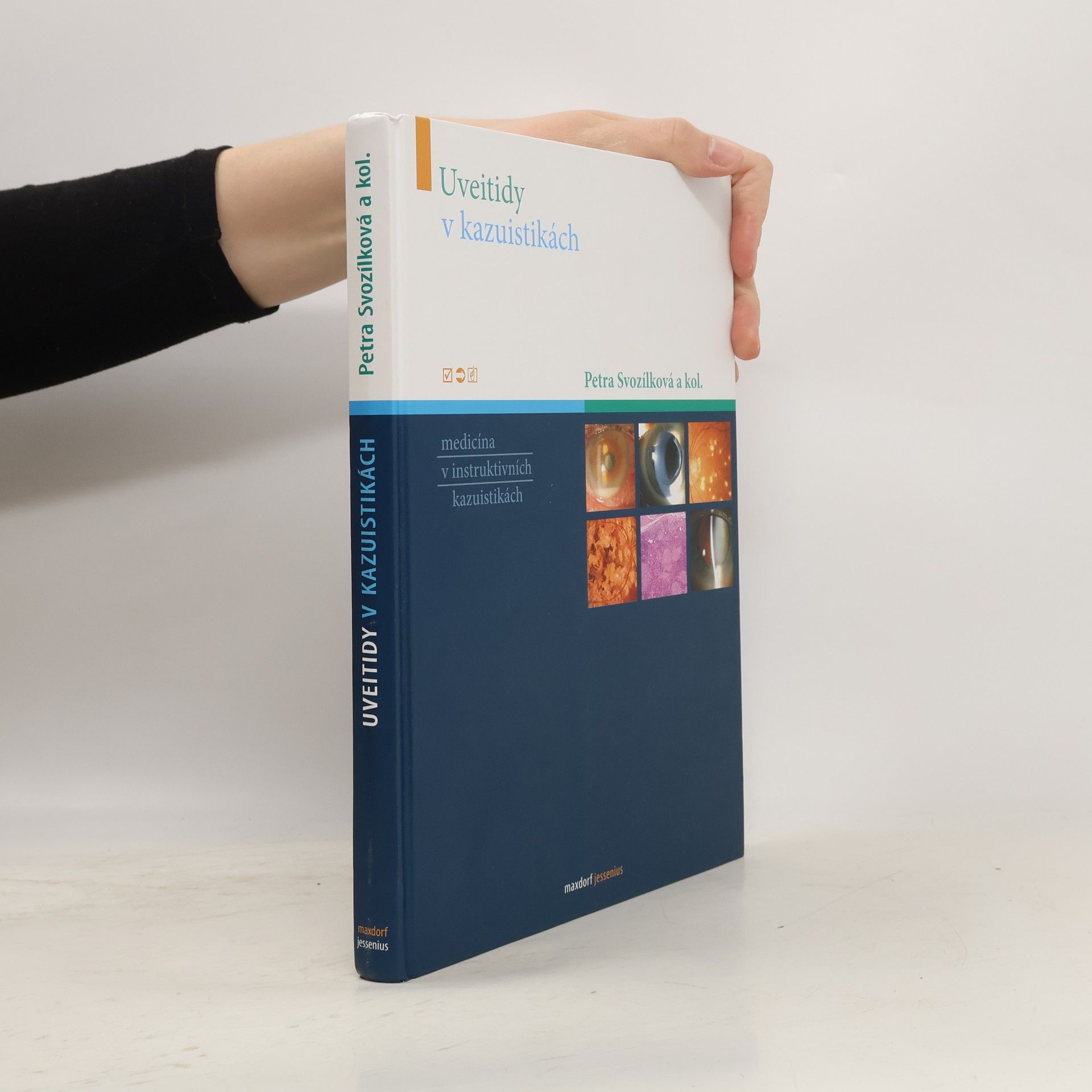 Petra Svozílková Uveitidy v kazuistikách