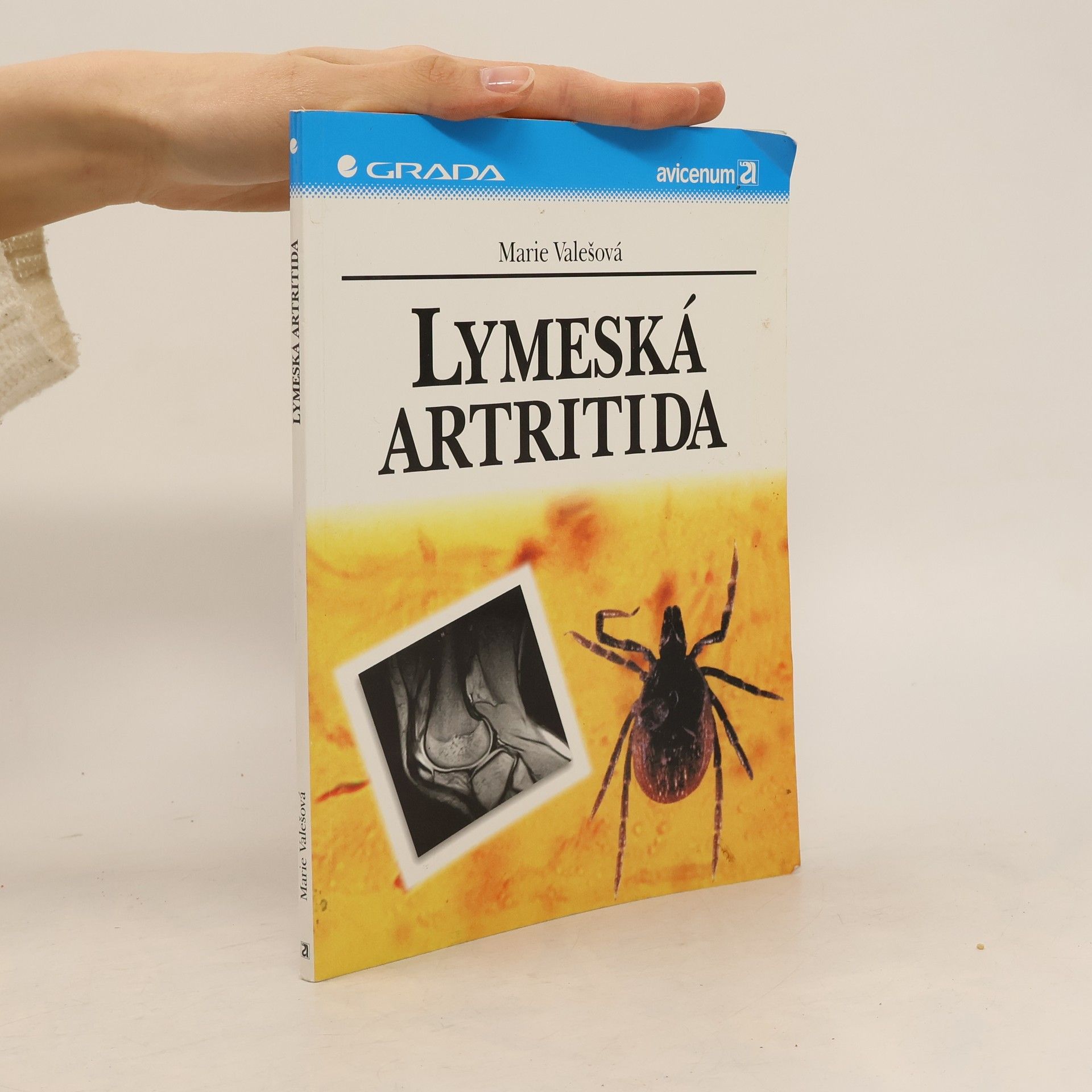 Marie Valešová Lymeská artritida