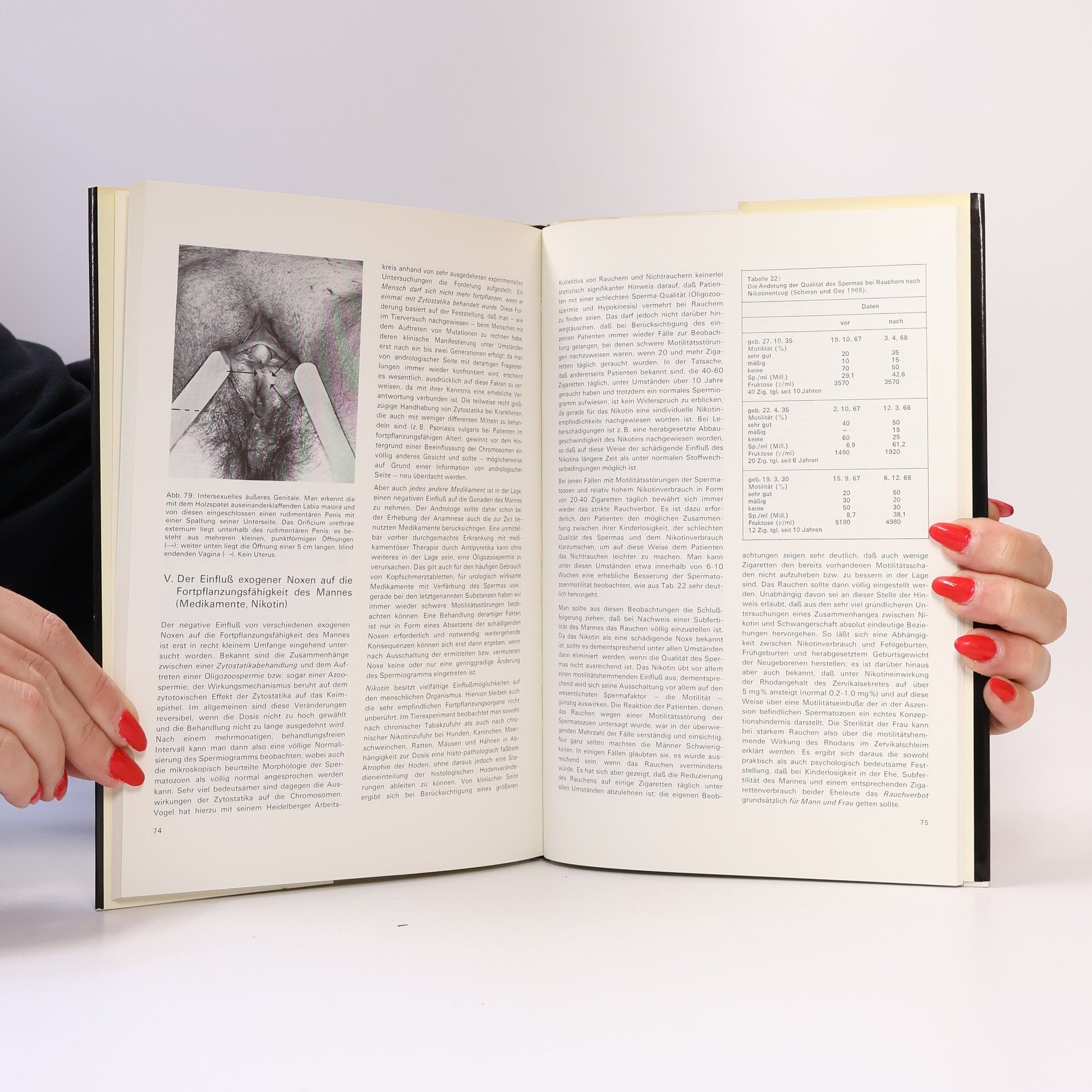 Carl Schirren Praktische Andrologie