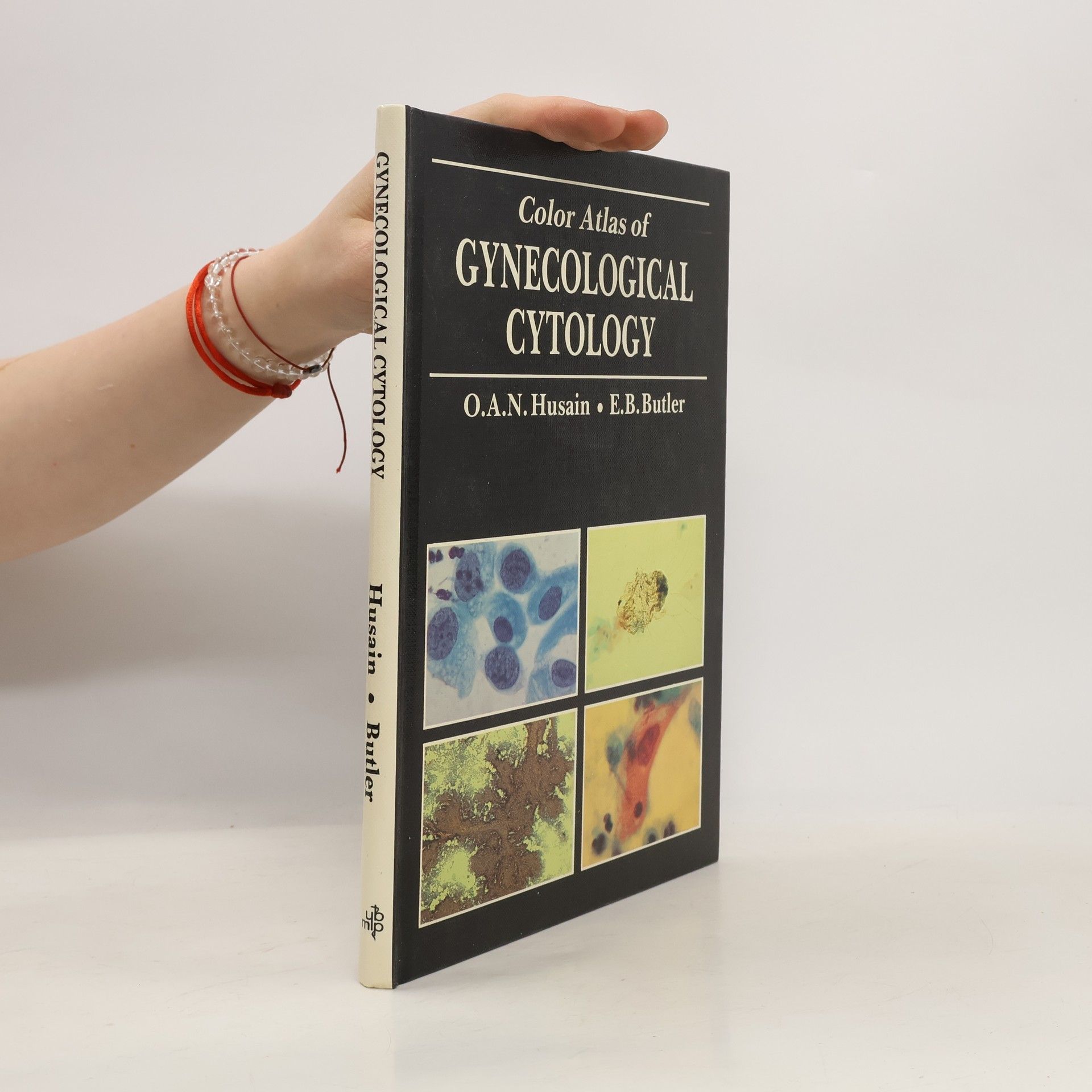 O. A. Nasseem Husain Color Atlas of Gynecological Cytology