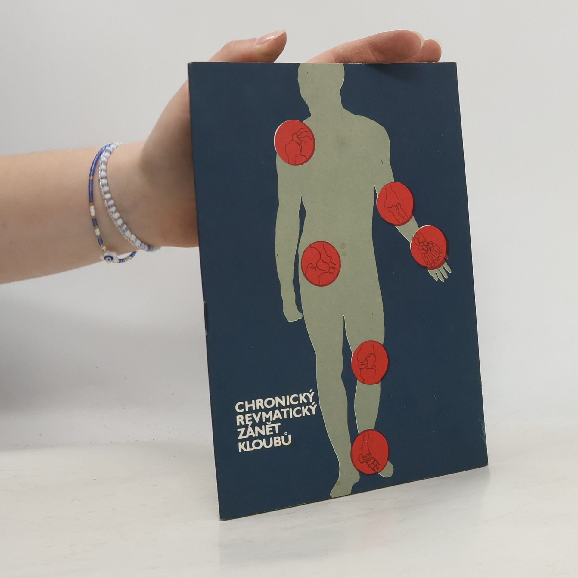 Z. Kubín Chronický revmatický zánět kloubů