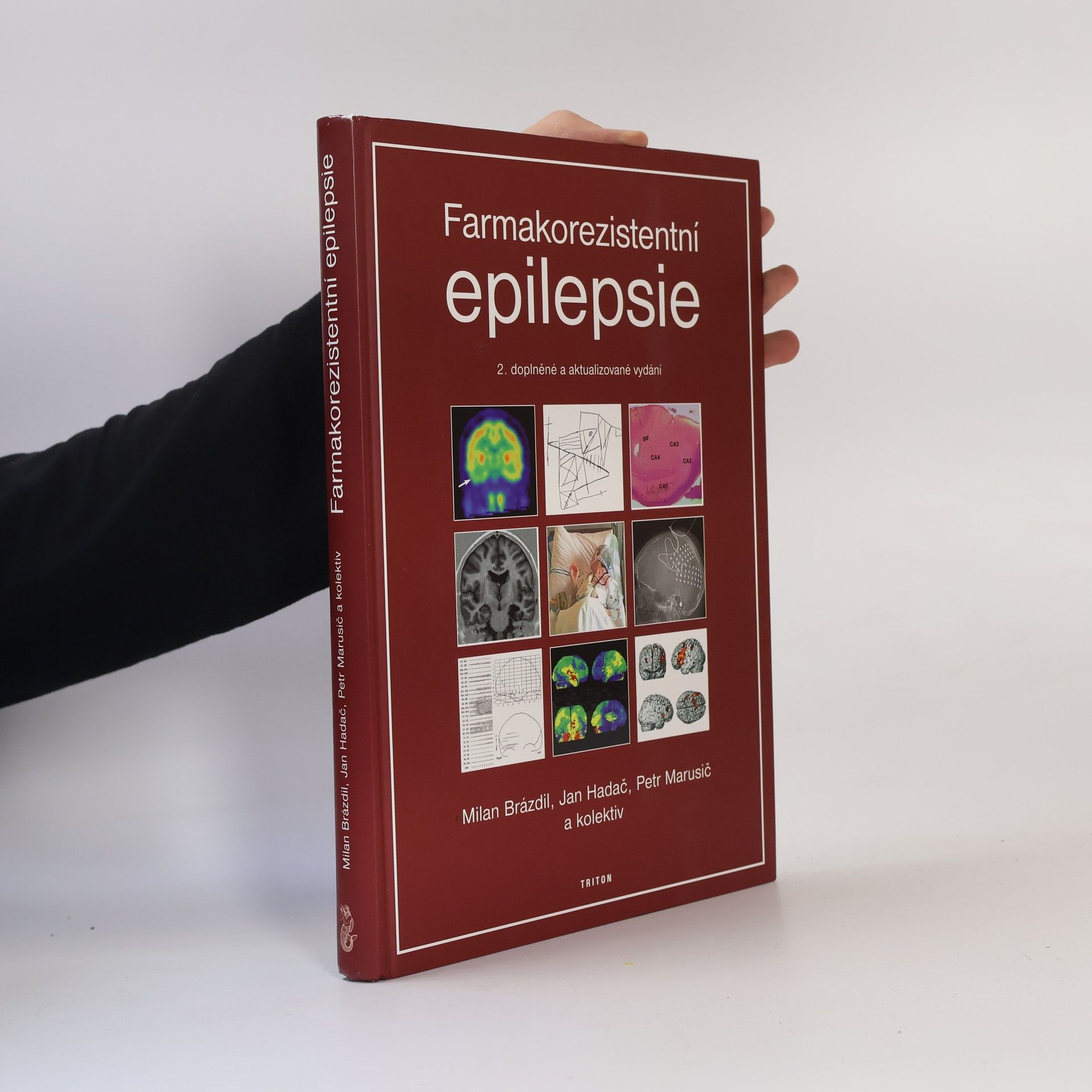 Milan Brázdil Farmakorezistentní epilepsie