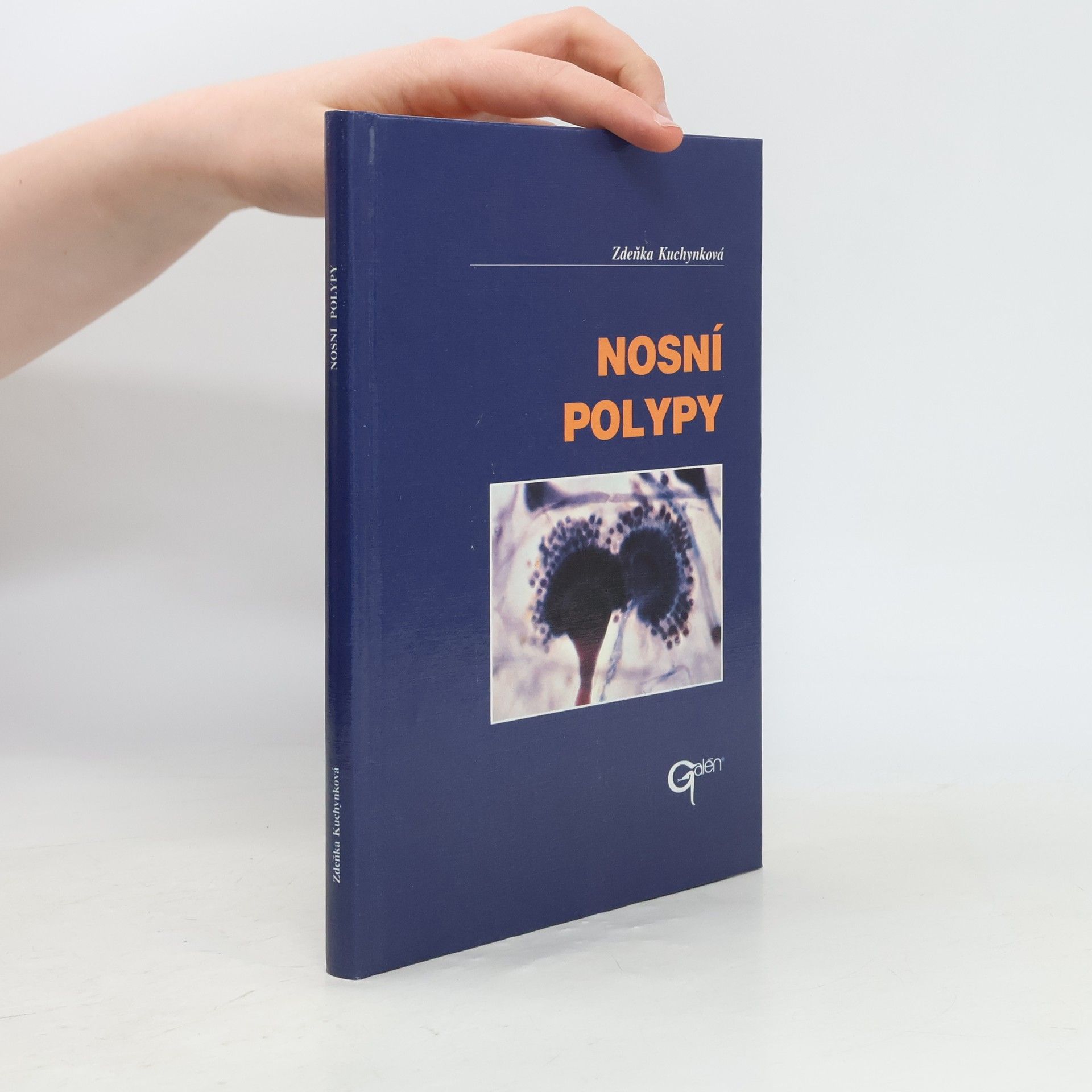 Zdeňka Kuchynková Nosní polypy