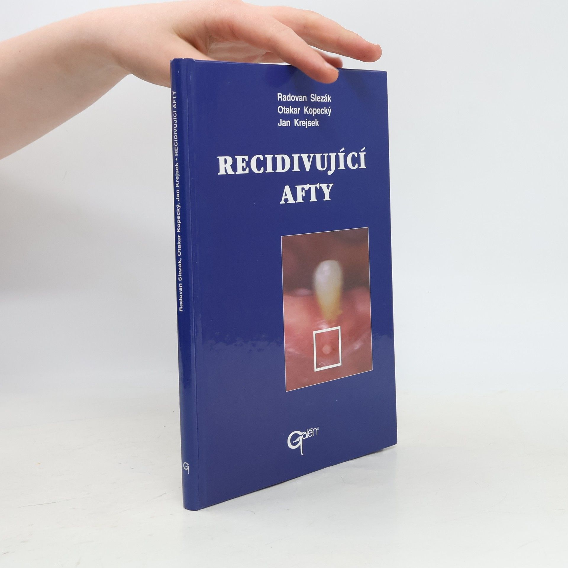 Radovan Slezák Recidivující afty