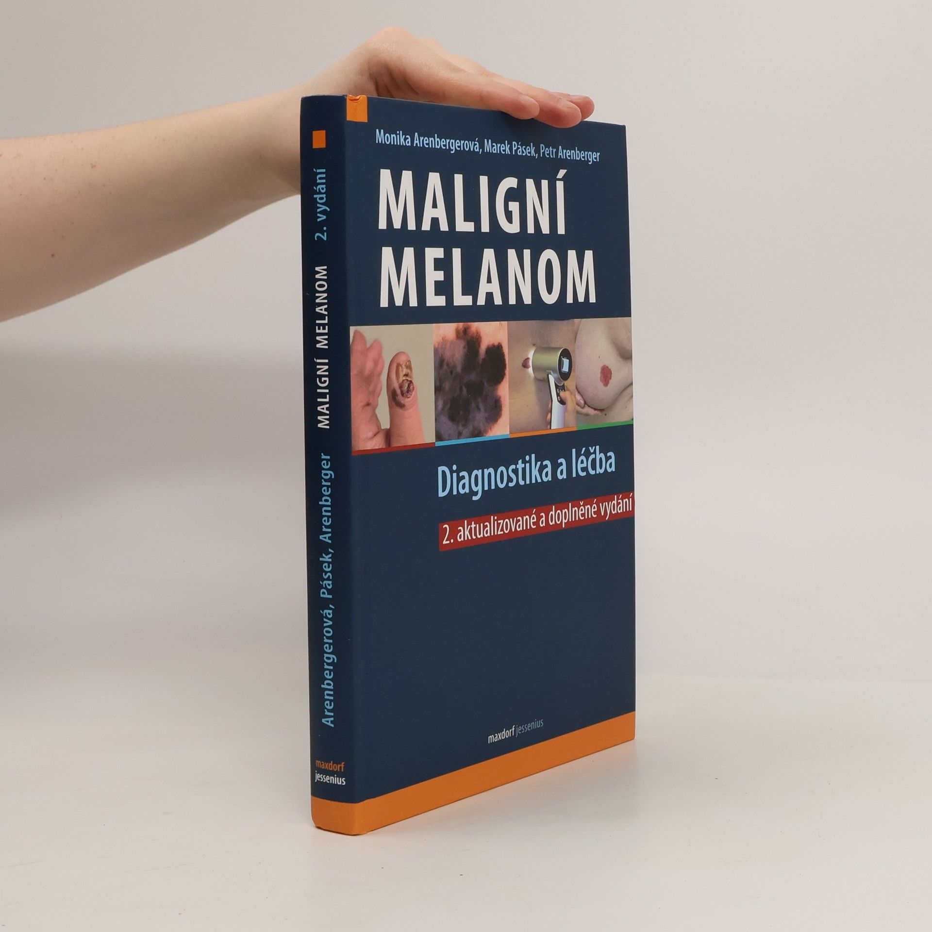 Monika Arenbergerová Maligní melanom - Diagnostika a léčba