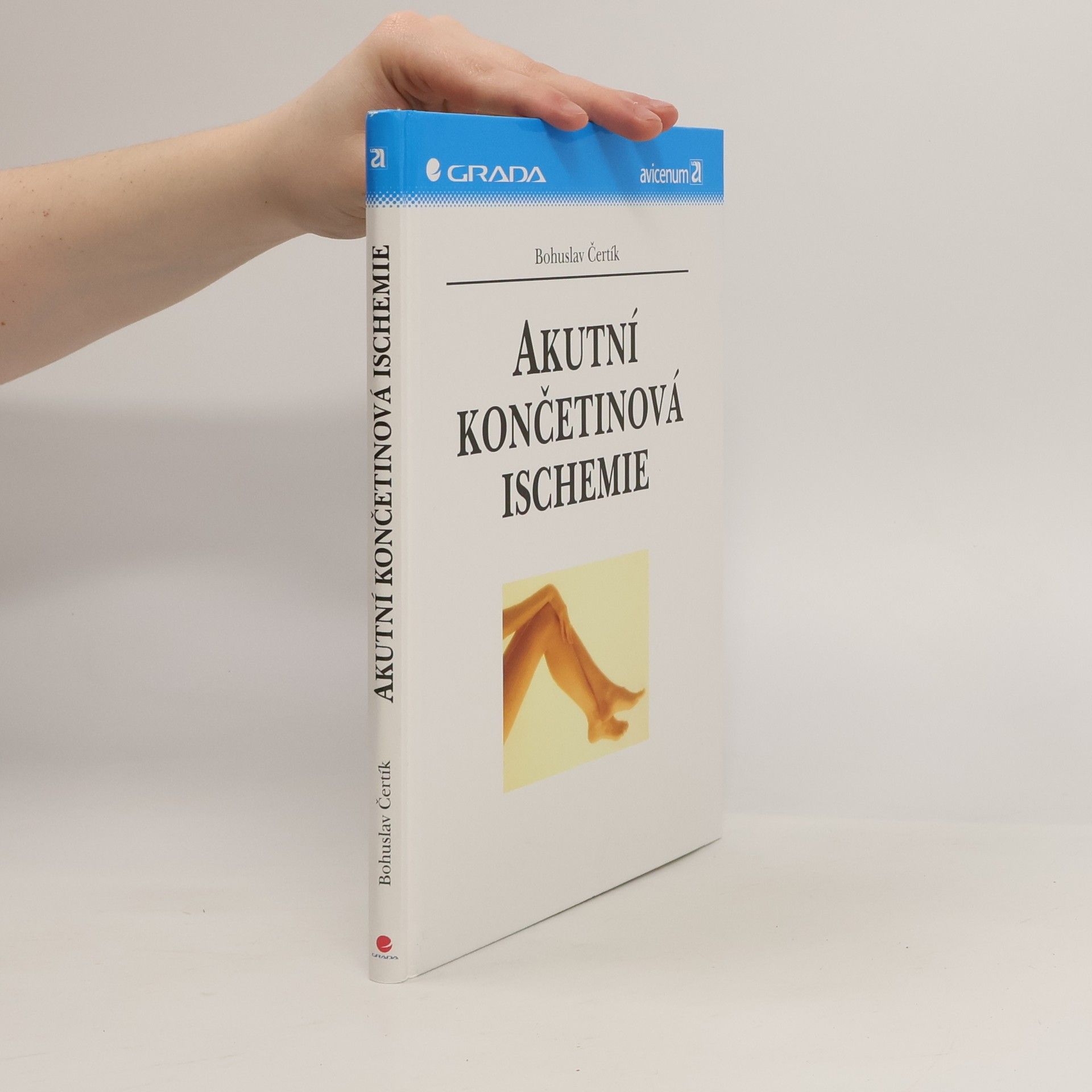 Akutní končetinová ischemie