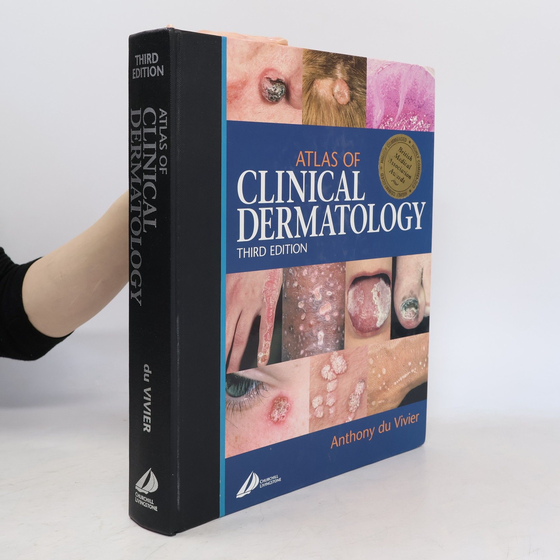 Anthony du Vivier MD FRCP Atlas of Clinical Dermatology - Third Edition