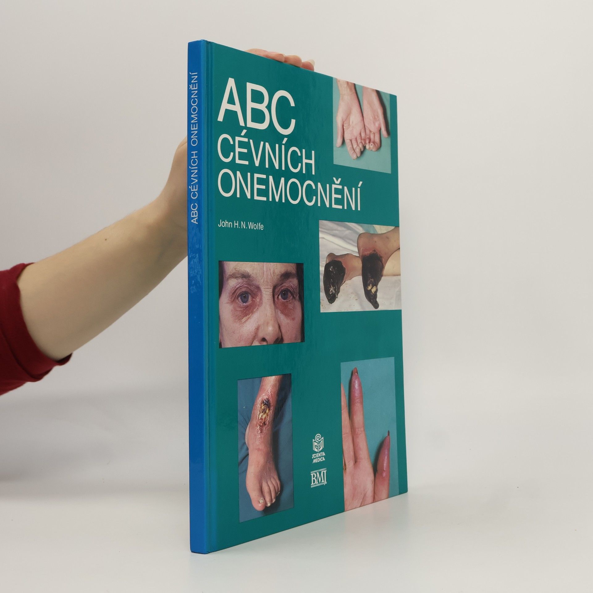 ABC cévních onemocnění