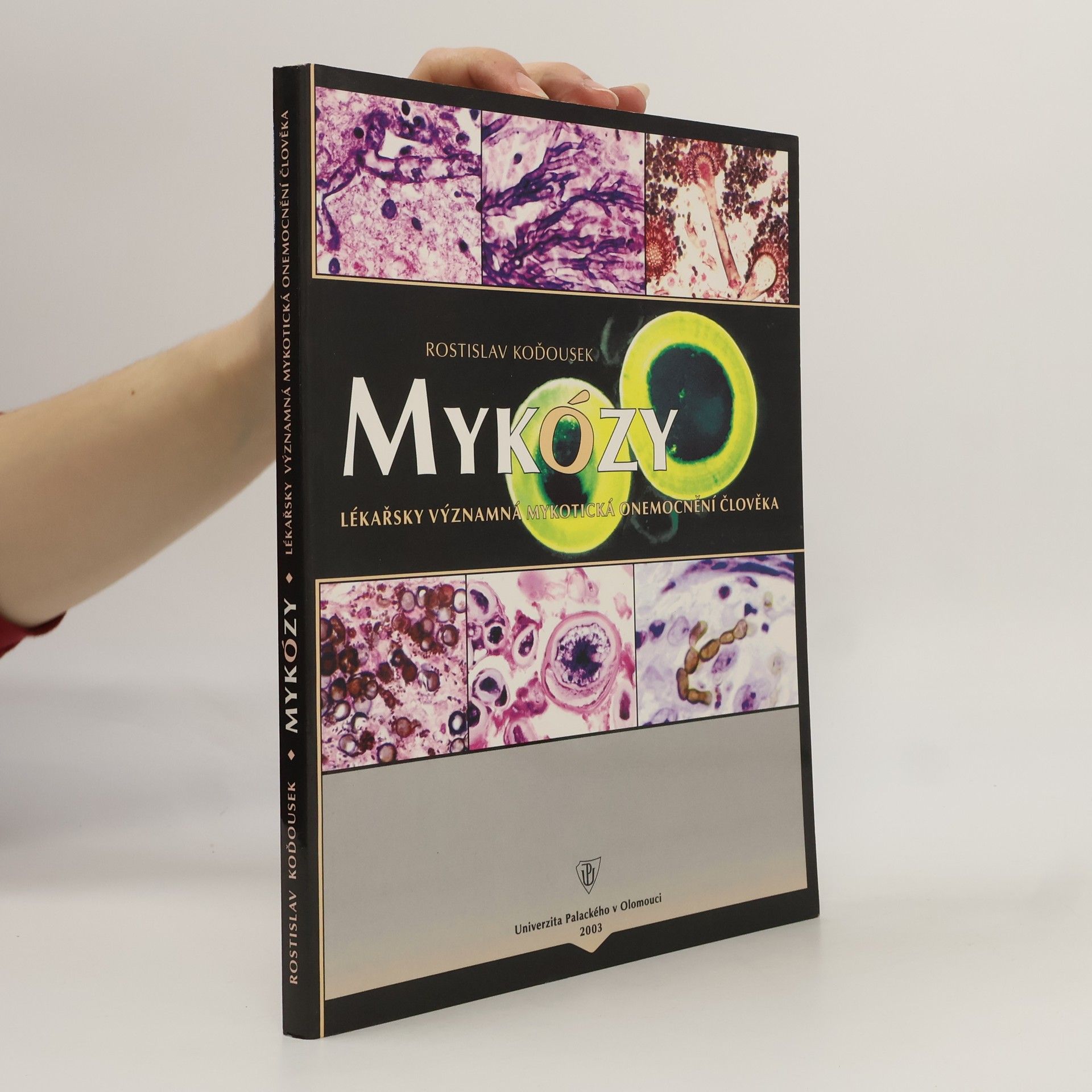 Rostislav Koďousek Mykózy