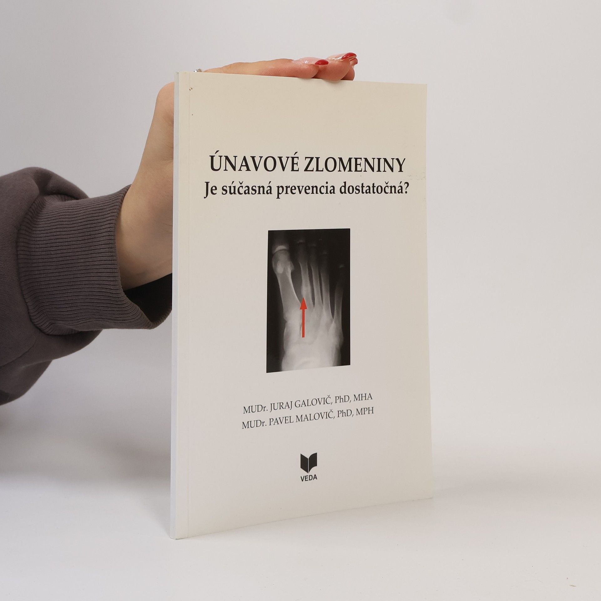 Juraj Galovič Únavové zlomeniny