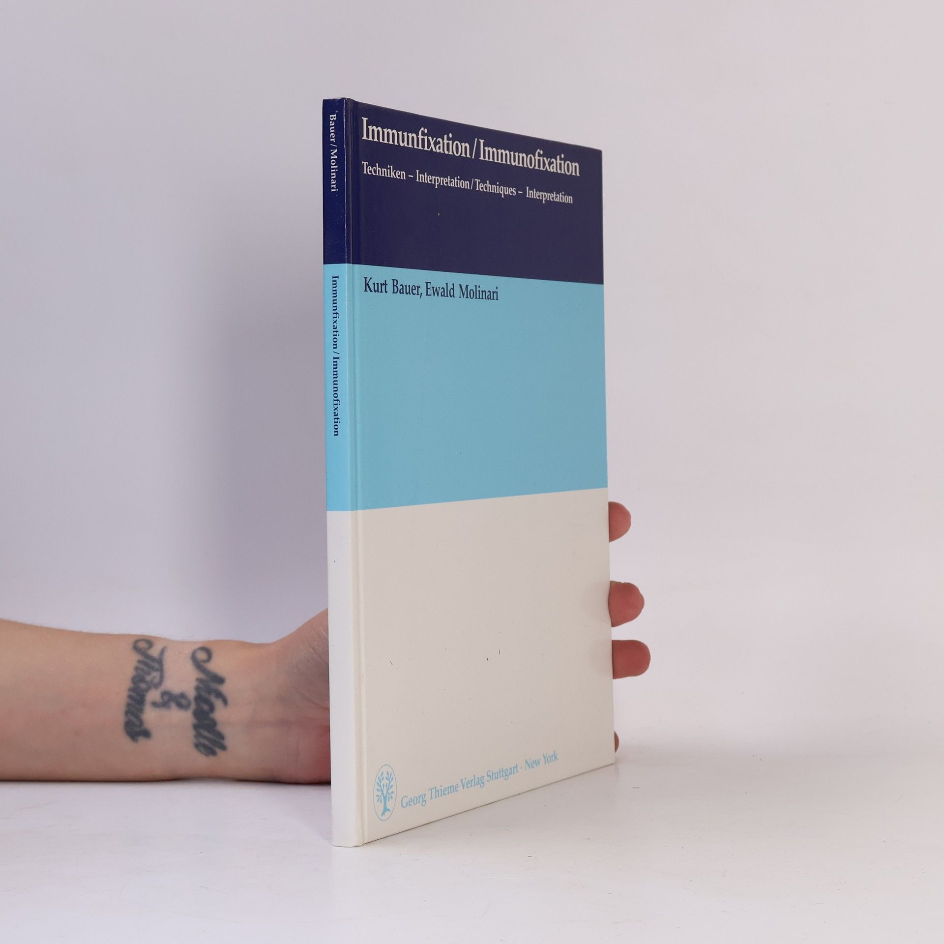 Enrico Molinari Immunfixation - Immunofixation